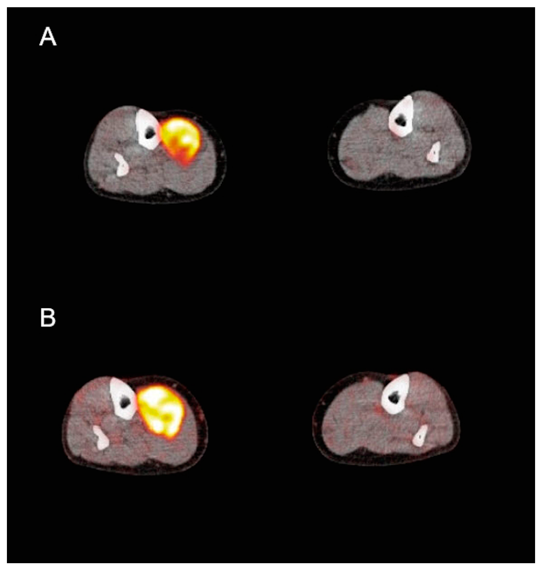 Cancers 11 00790 g004 Cancers 11 00790 g004