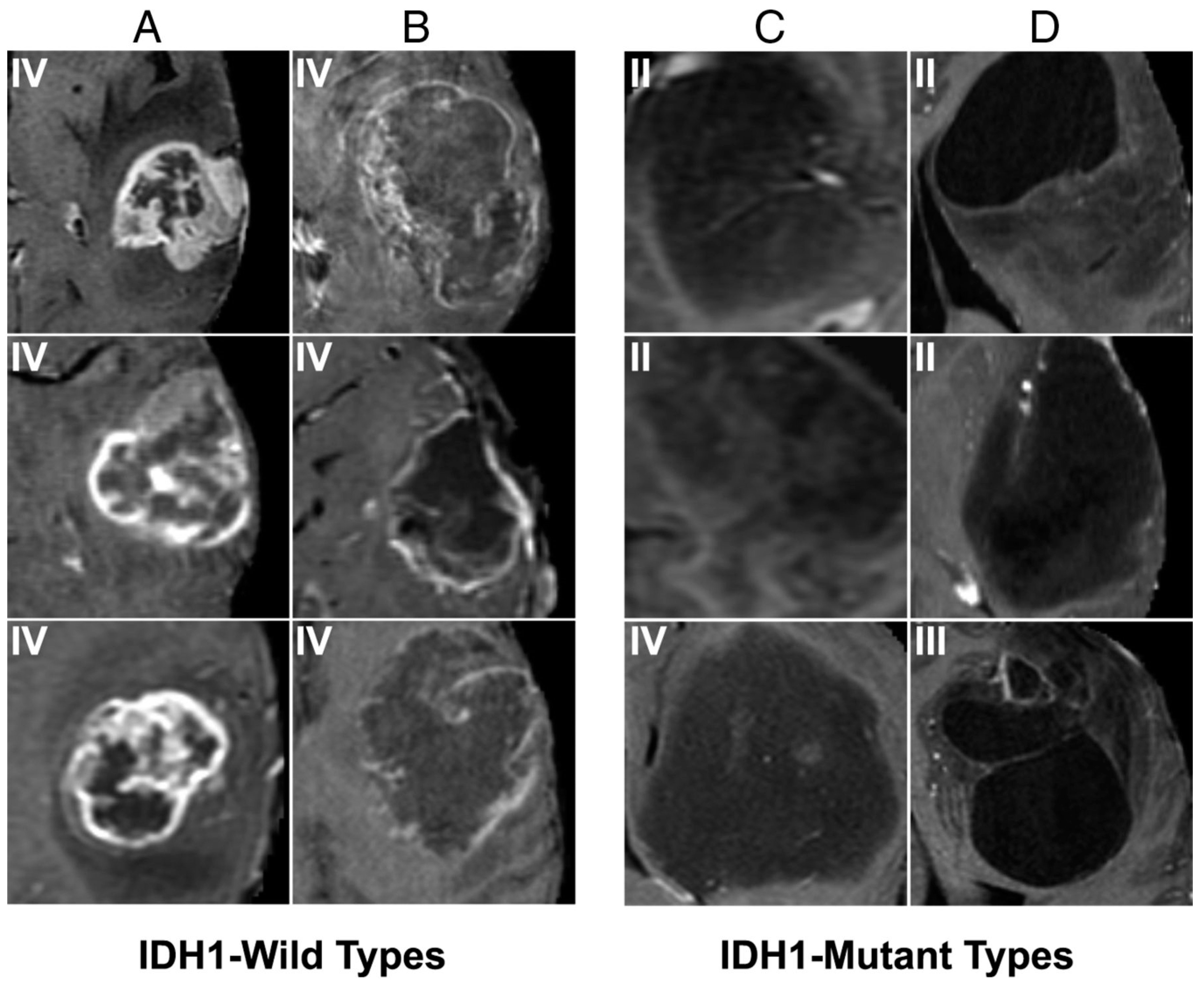 Cancers Free Full Text Optimizing Neuro Oncology Imaging A Review Of Deep Learning Approaches For Glioma Imaging Html