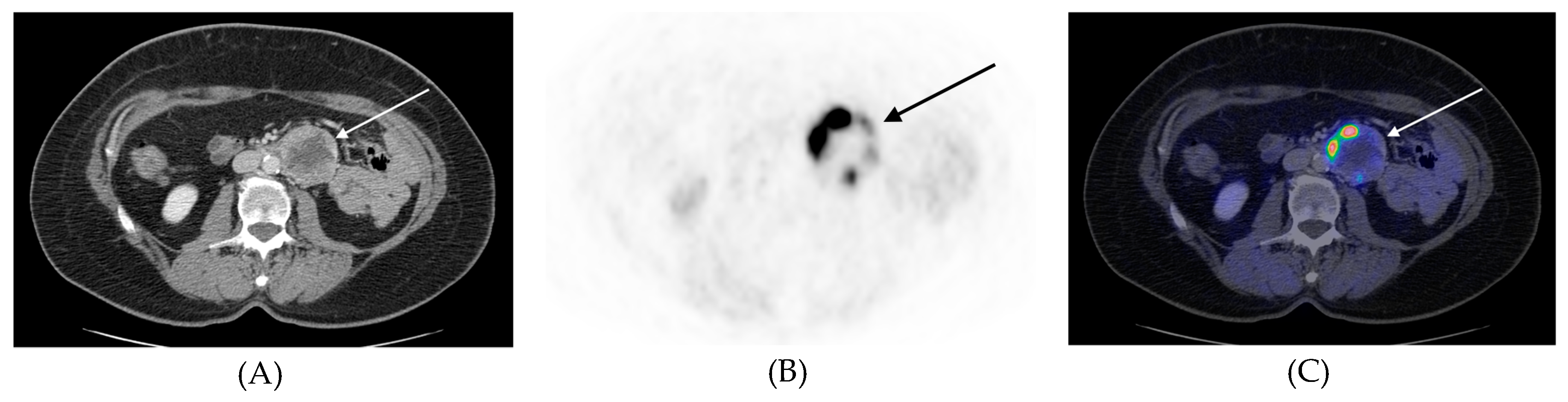 Cancers 11 00847 g002 Cancers 11 00847 g002