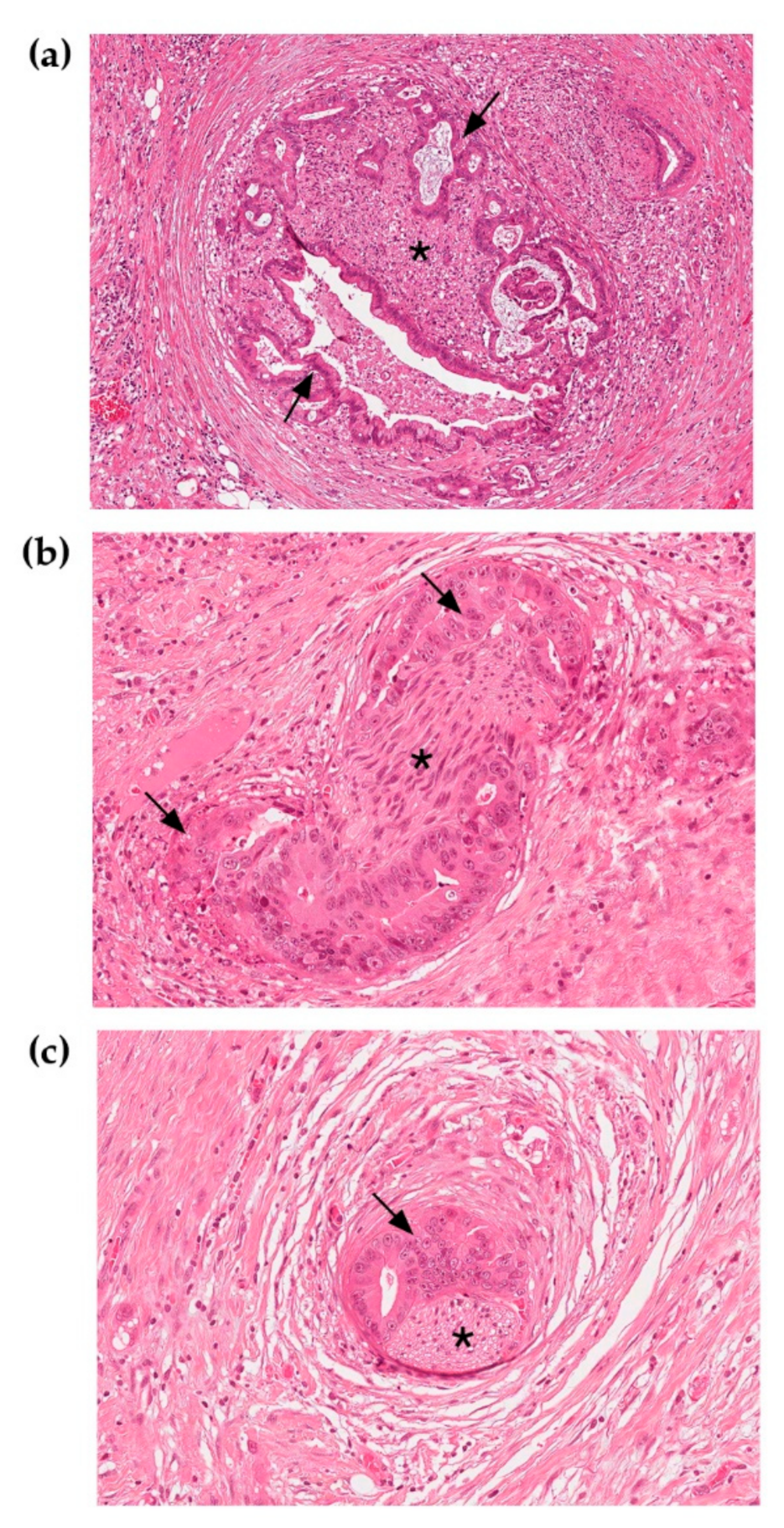 Cancers 11 00893 g001 Cancers 11 00893 g001