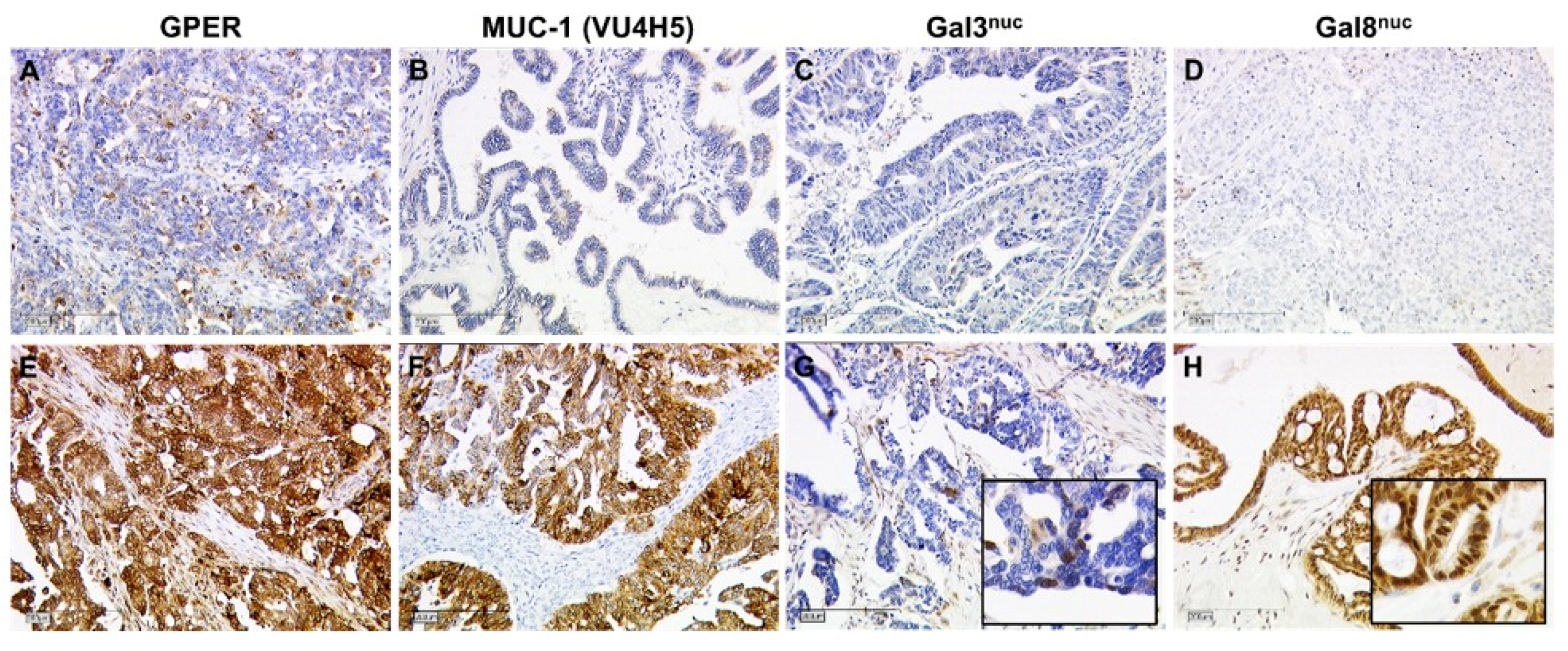 Cancers 11 00924 g004 550