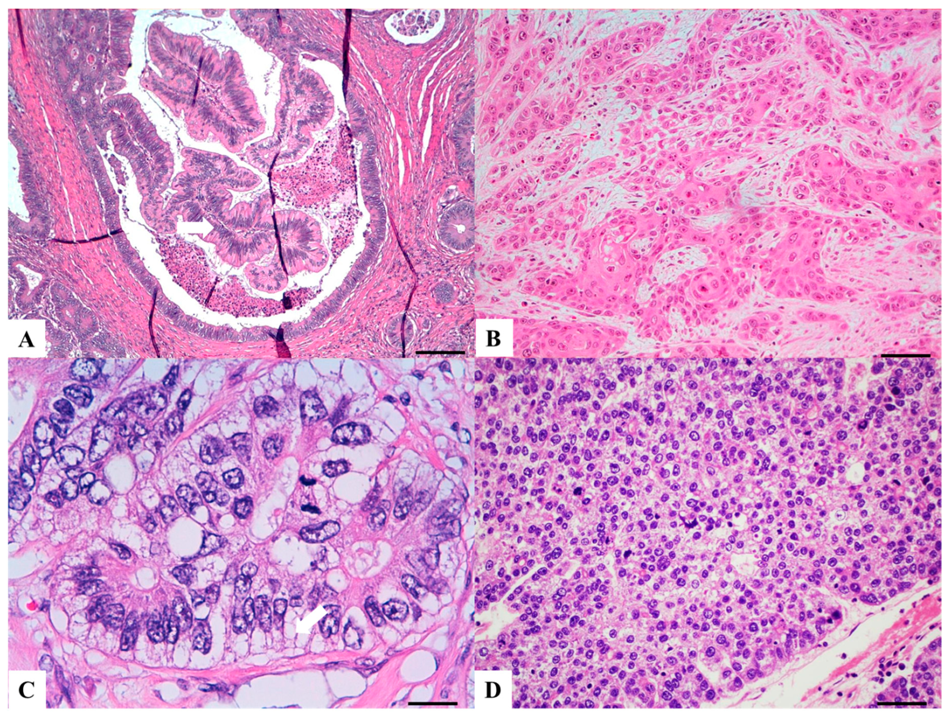 Morphology and Molecular Features of Rare Colorectal