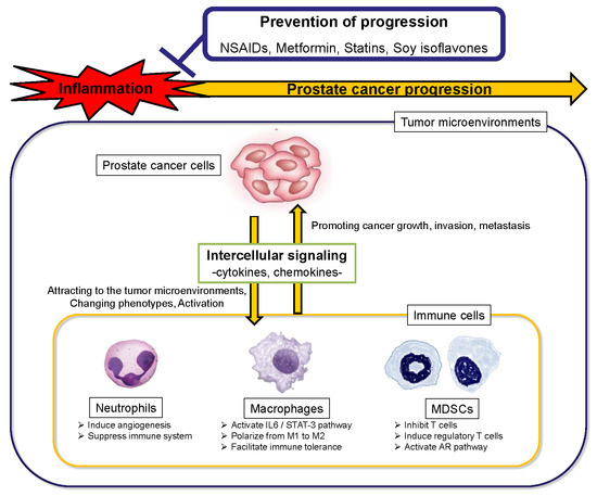 Prostatitis 29- ben)