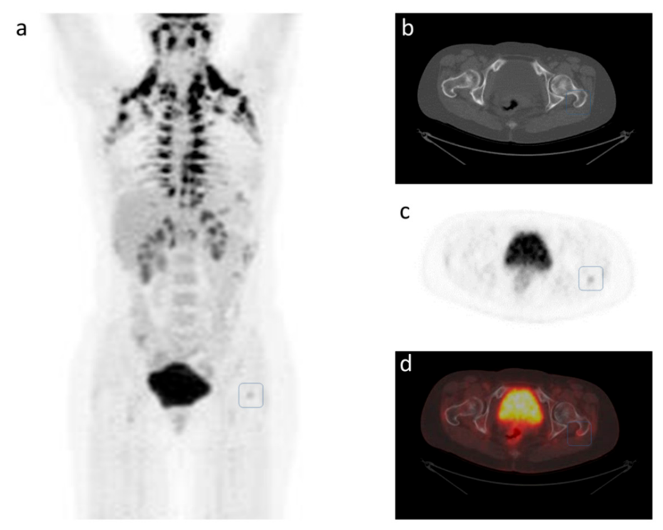 Cancers 11 01190 g001