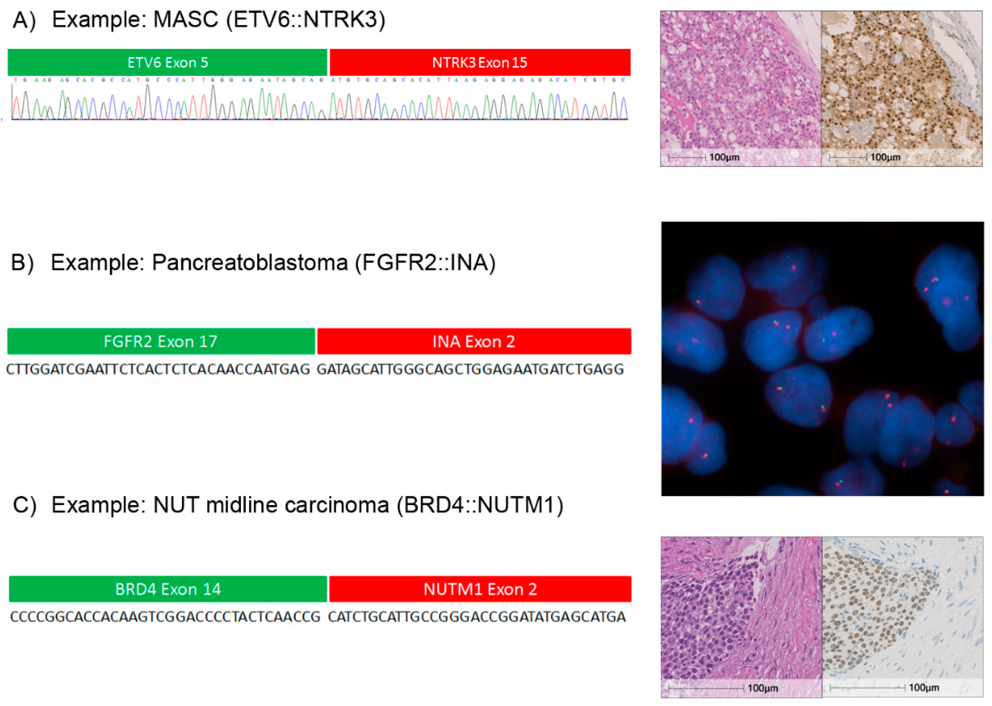 Cancers 11 01309 g005 Cancers 11 01309 g005