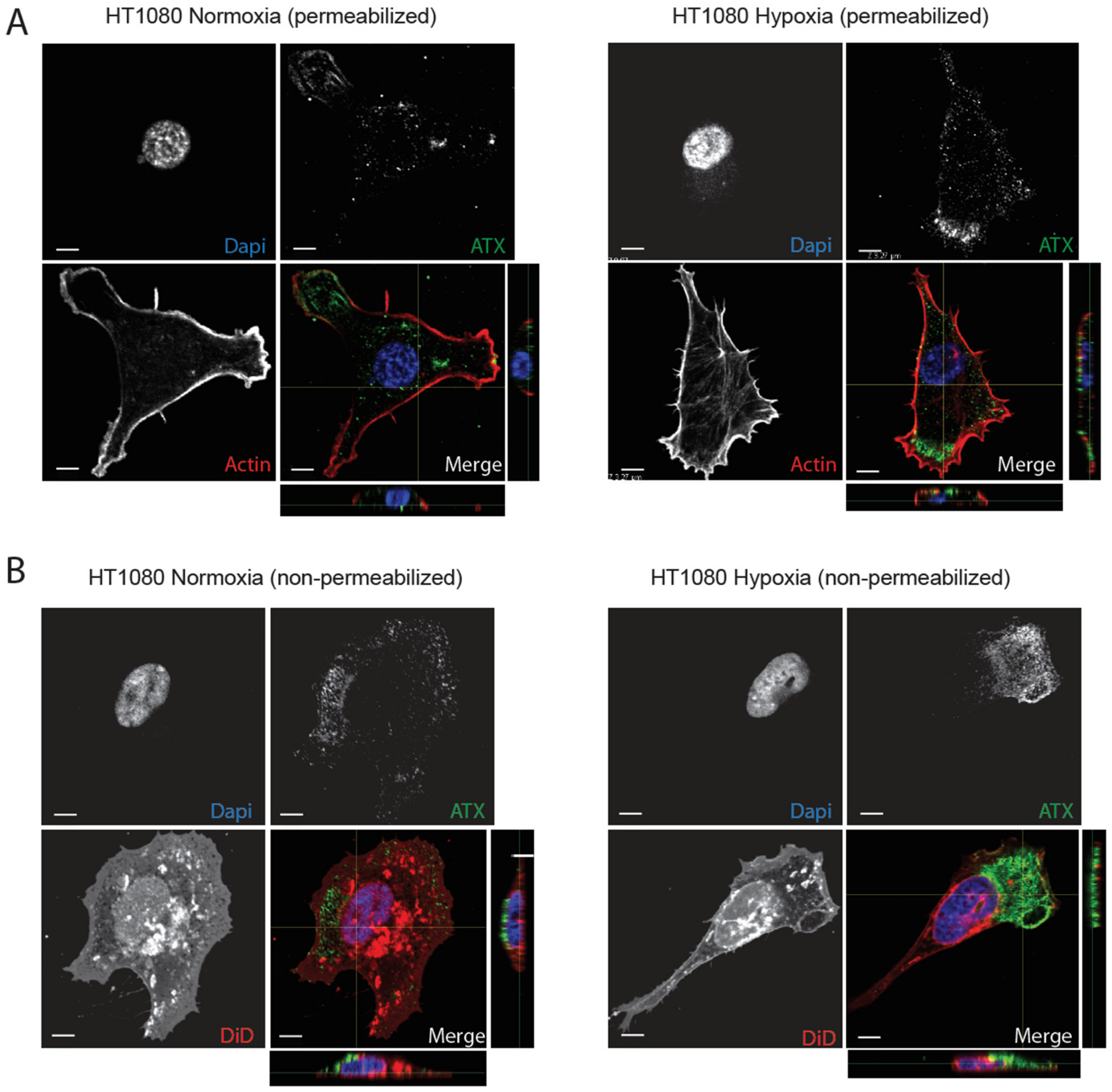 Cancers 11 01403 g004