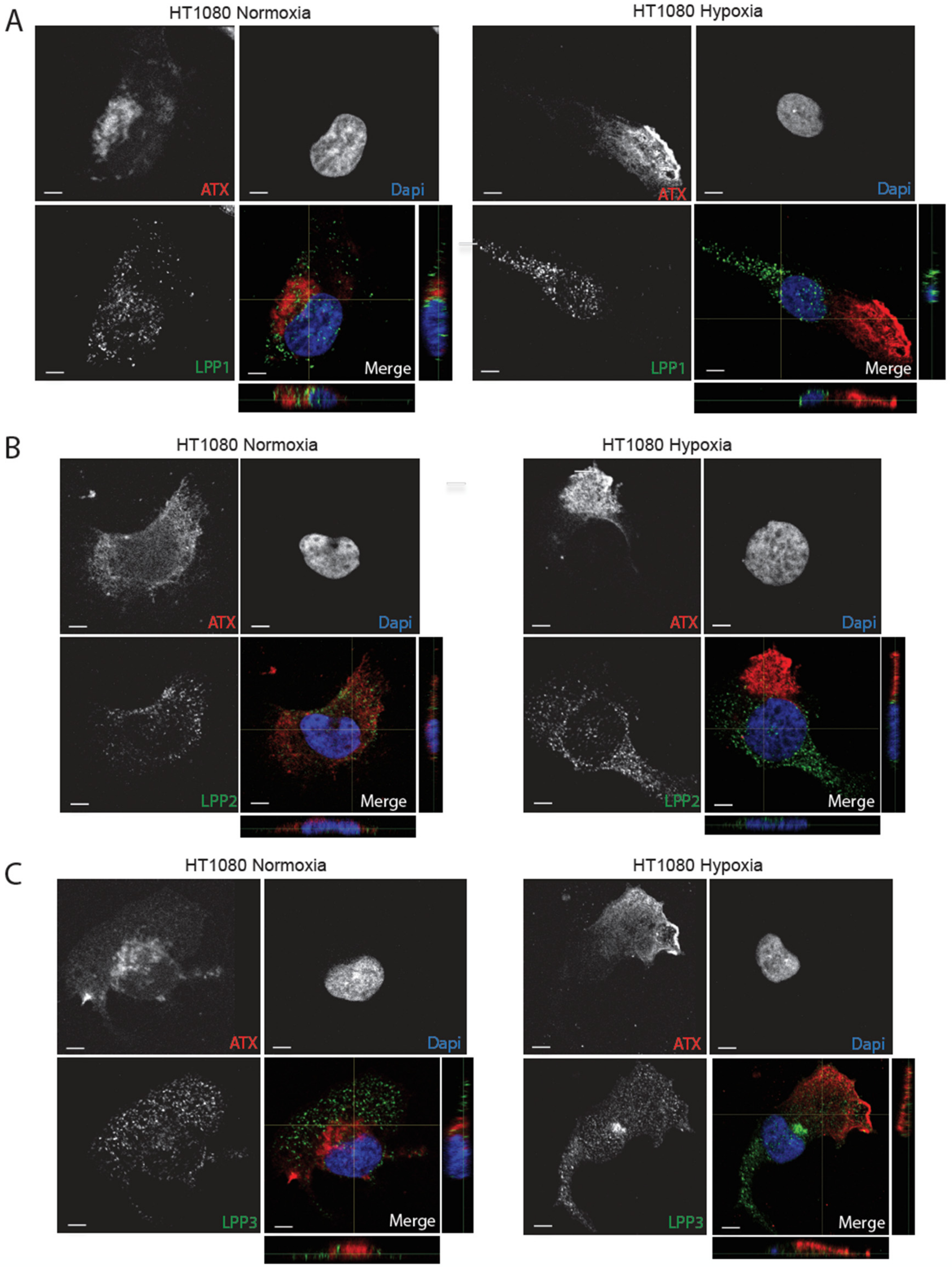 Cancers 11 01403 g005