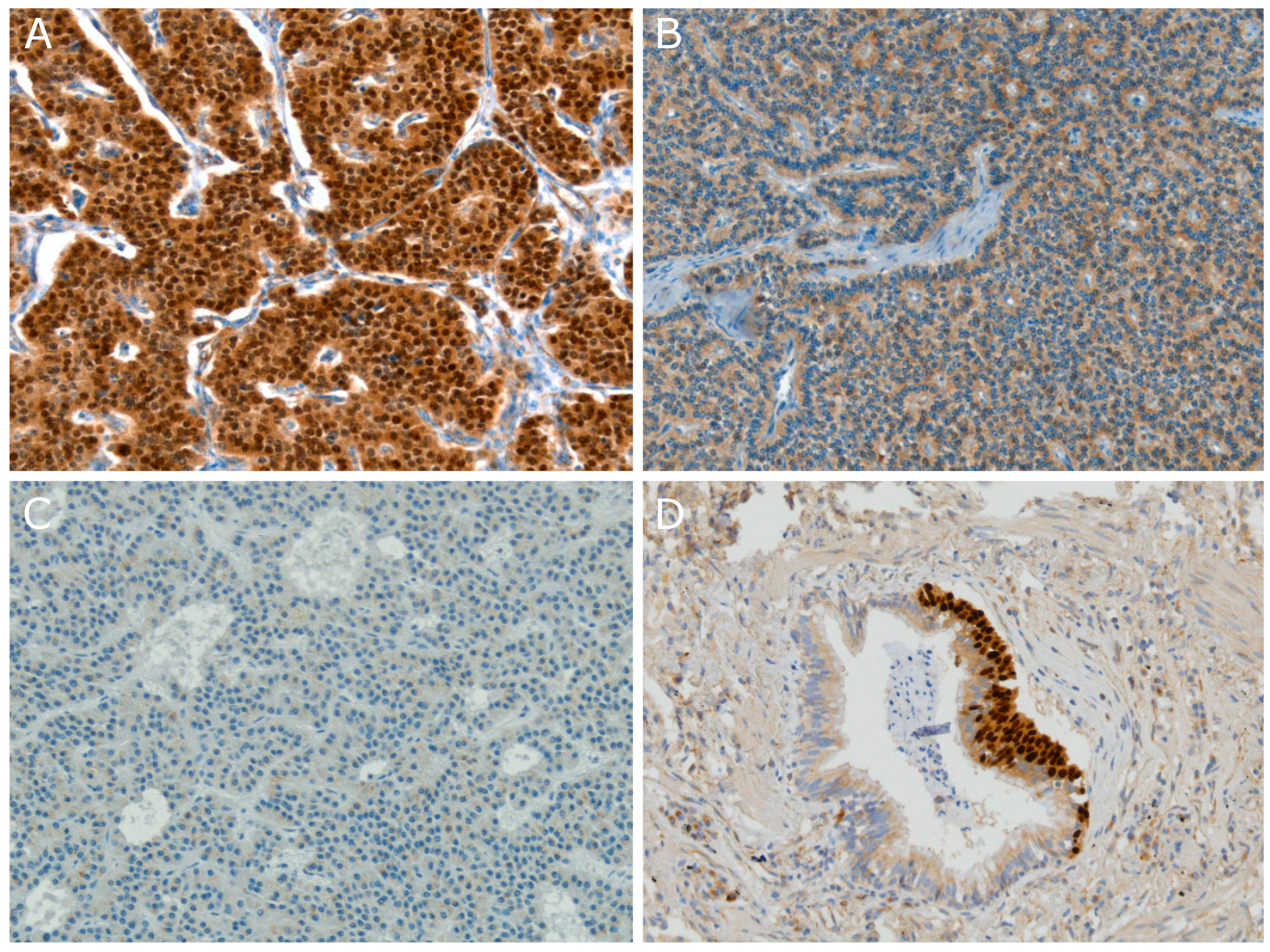 Cancers 11 01508 g001 Cancers 11 01508 g001