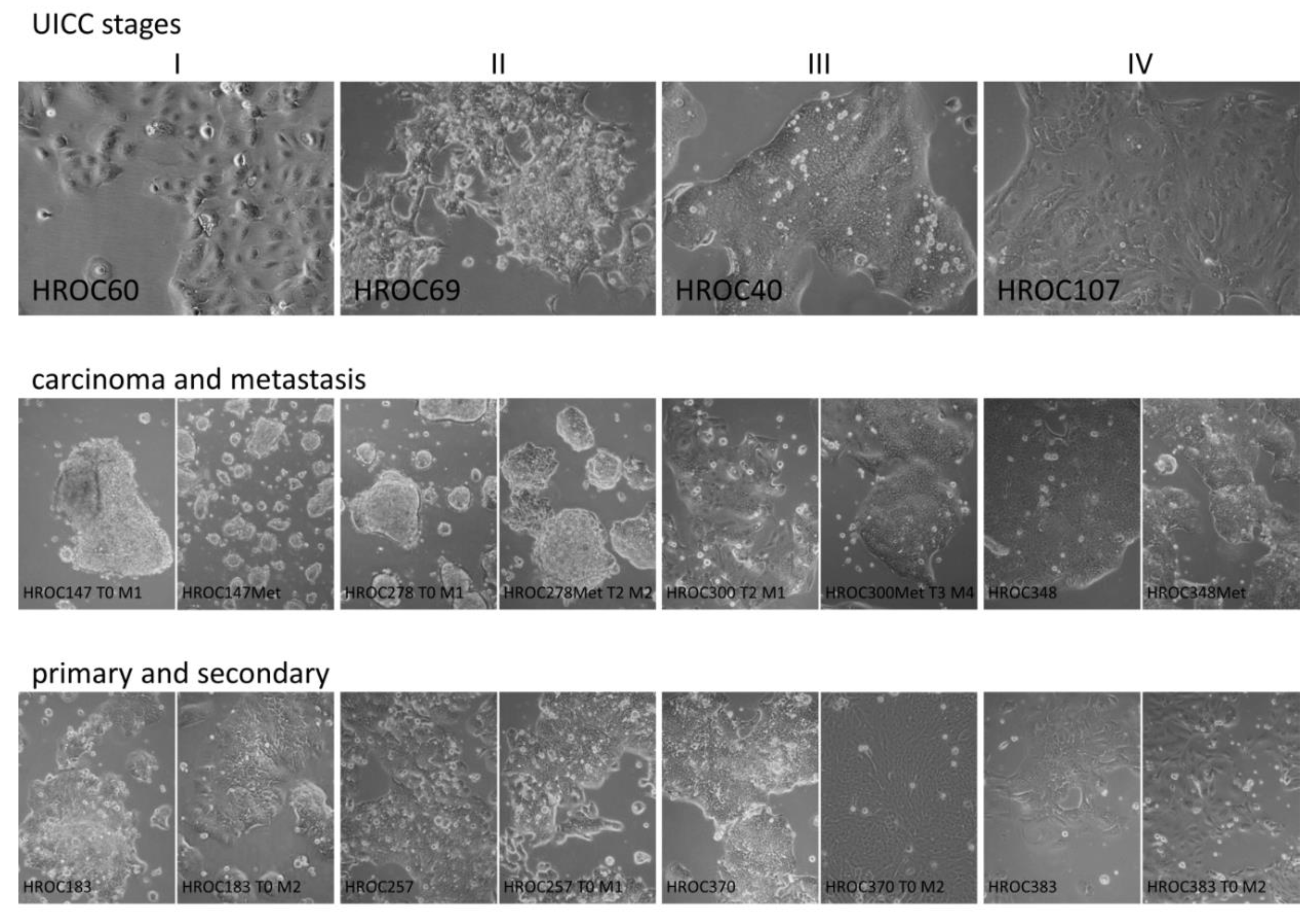 Cancers 11 01520 g001 Cancers 11 01520 g001