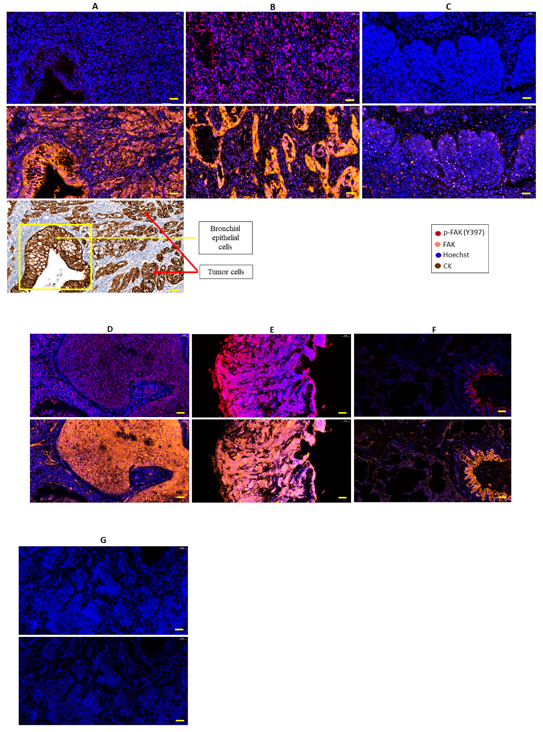 Cancers 11 01526 g002 Cancers 11 01526 g002
