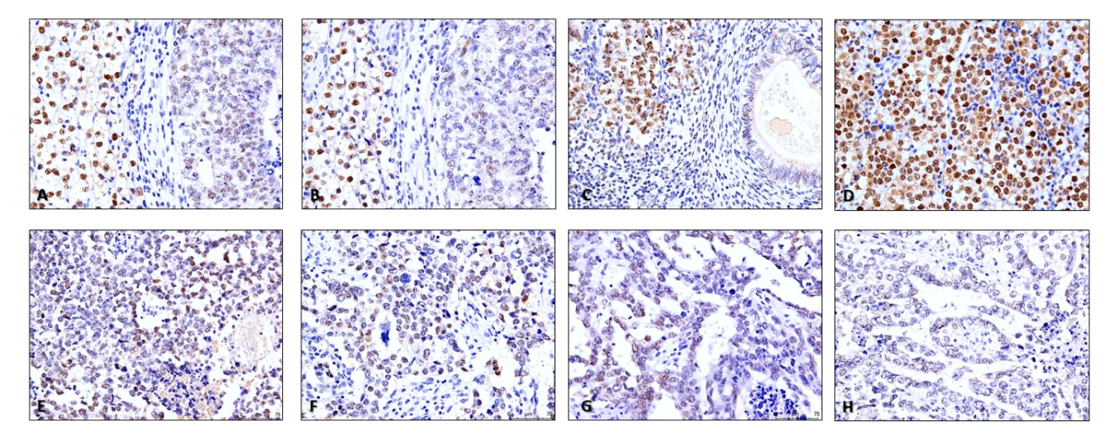 Cancers 11 01535 g007 Cancers 11 01535 g007