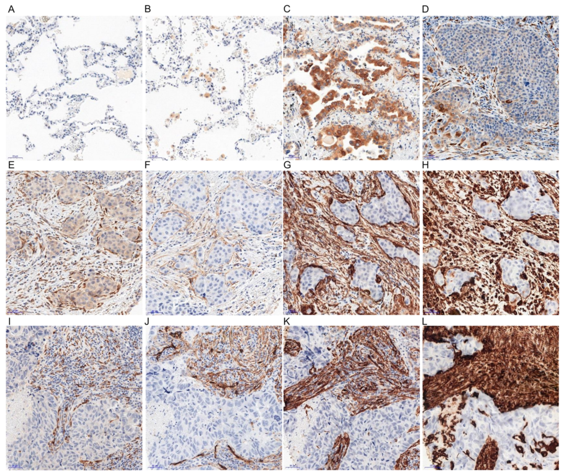 Cancers 11 01538 g001 Cancers 11 01538 g001