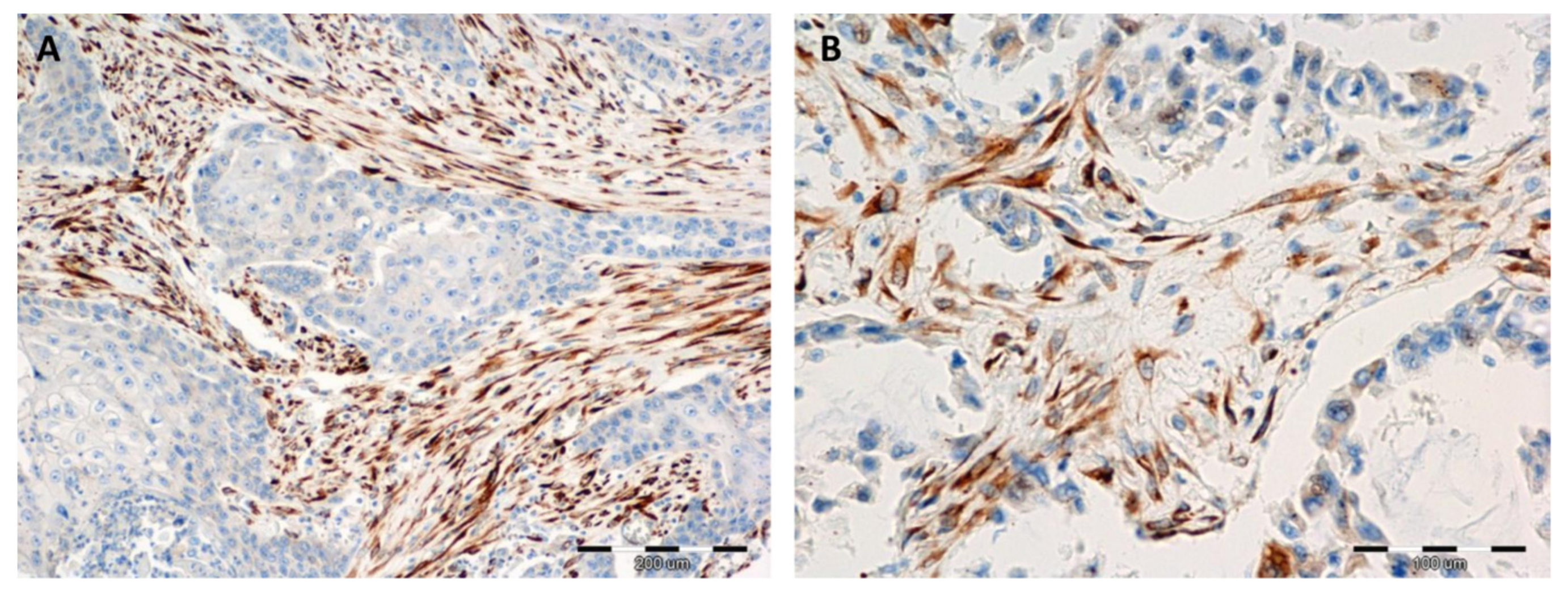 Cancers 11 01538 g002 Cancers 11 01538 g002