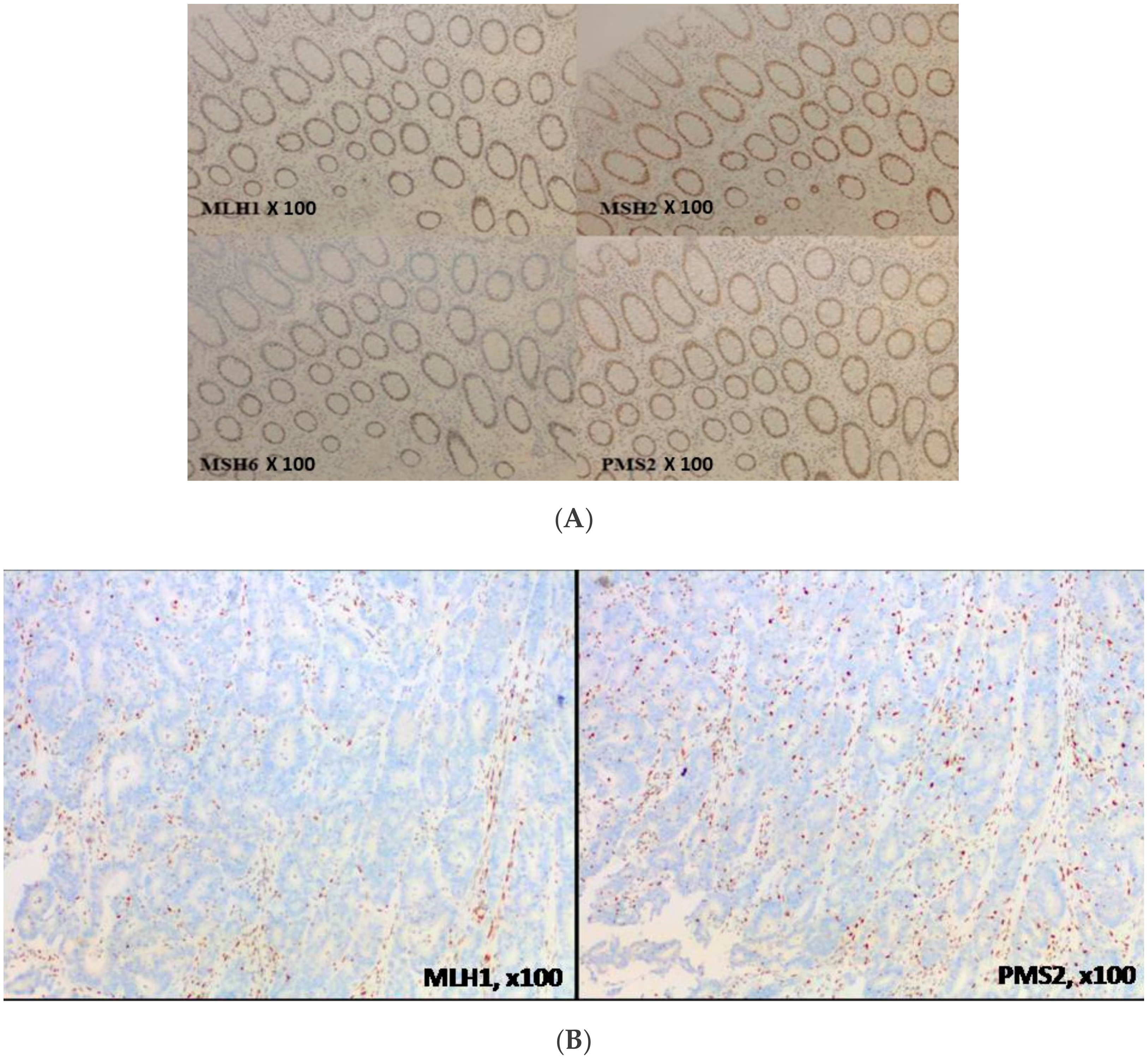 Cancers 11 01567 g004 Cancers 11 01567 g004