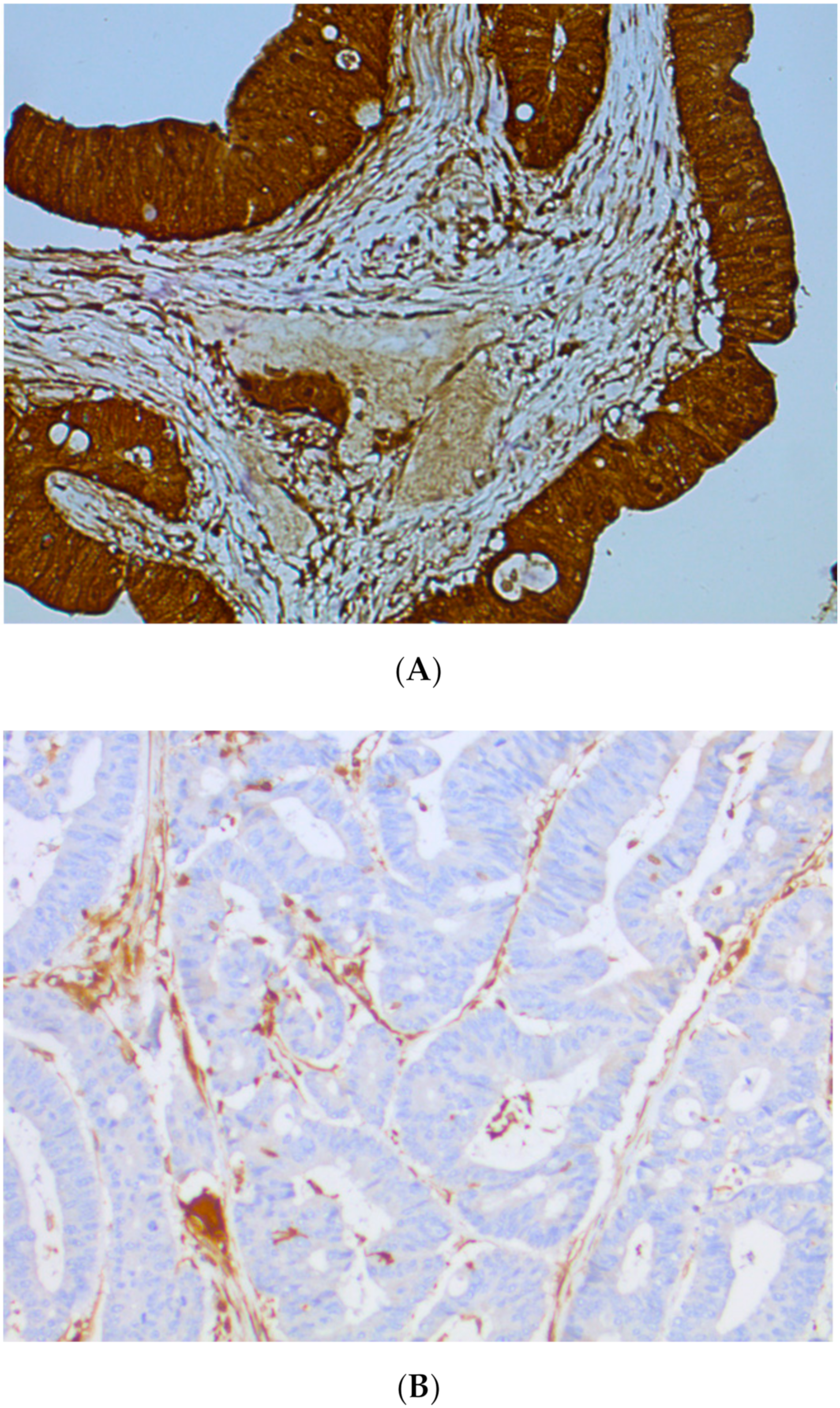 Cancers 11 01567 g007 Cancers 11 01567 g007