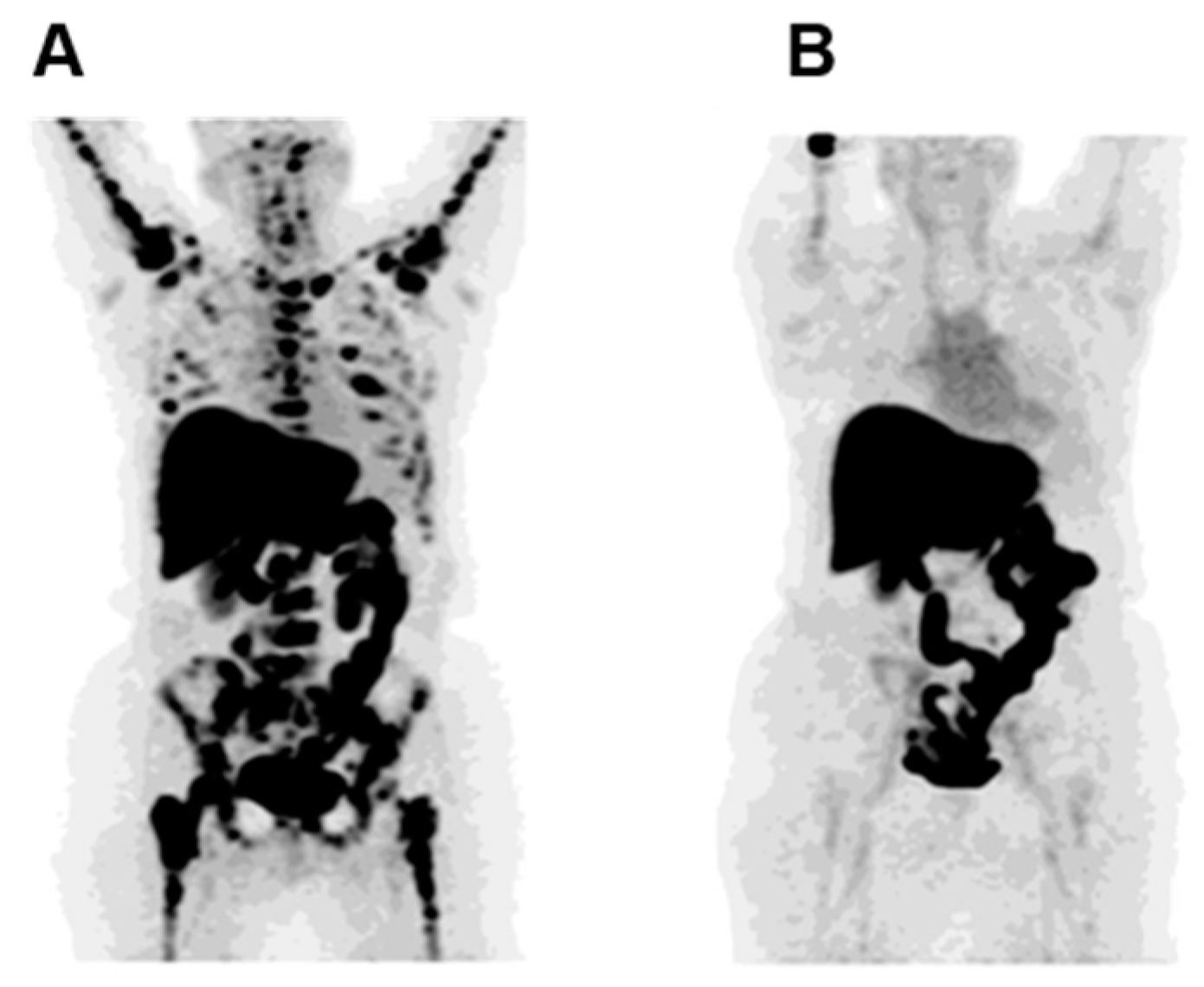 Cancers Free Full Text Recent Advances In Nuclear Imaging