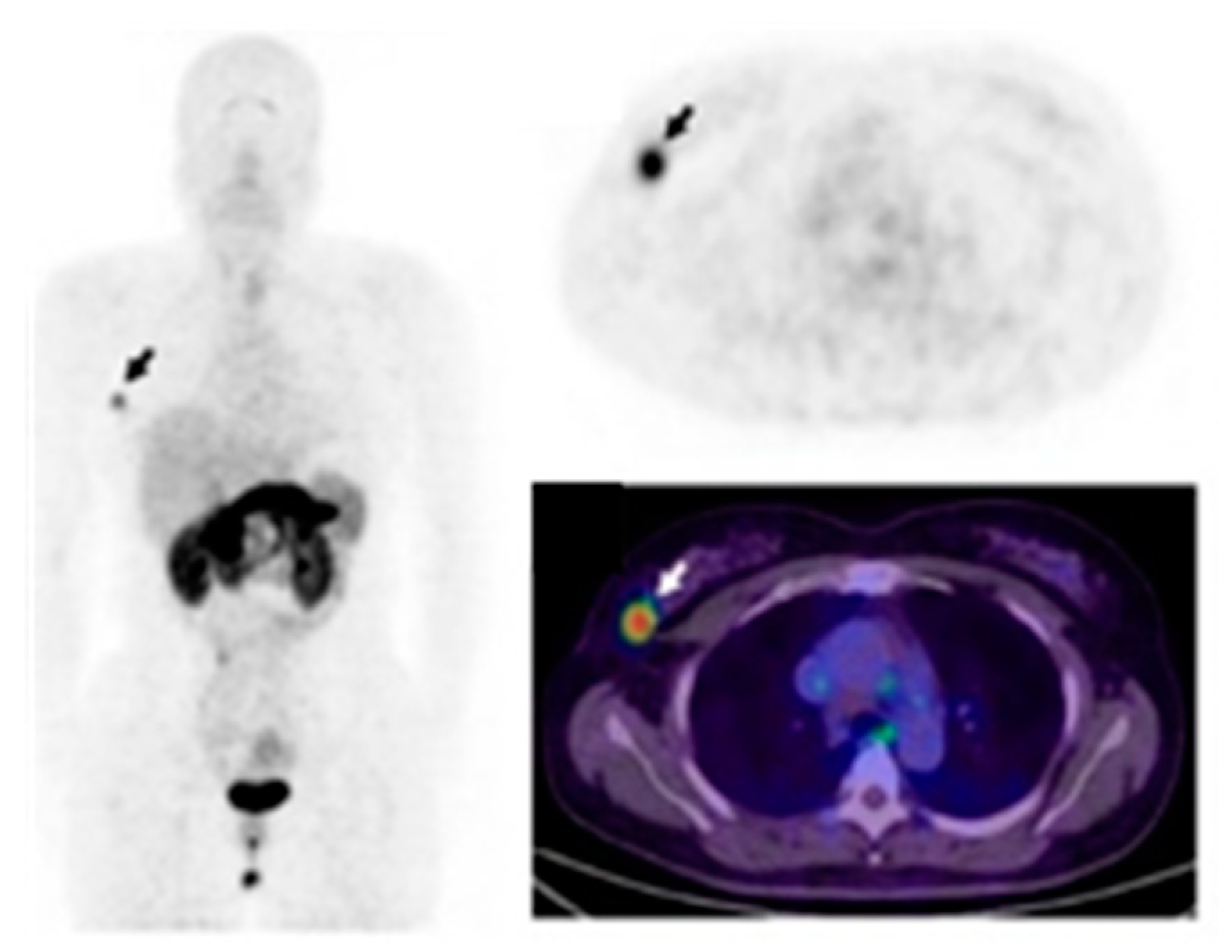 Cancers 11 01614 g003 Cancers 11 01614 g003