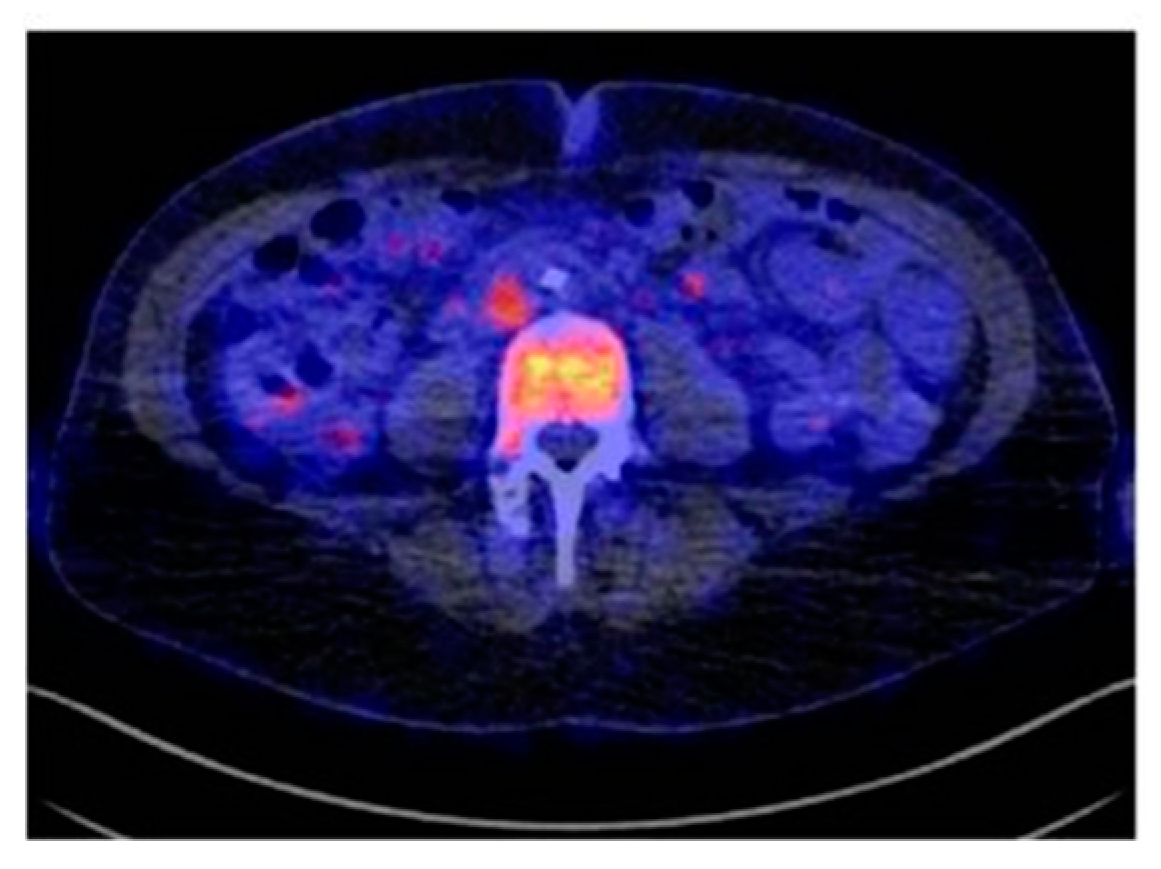 Cancers 11 01614 g005 Cancers 11 01614 g005