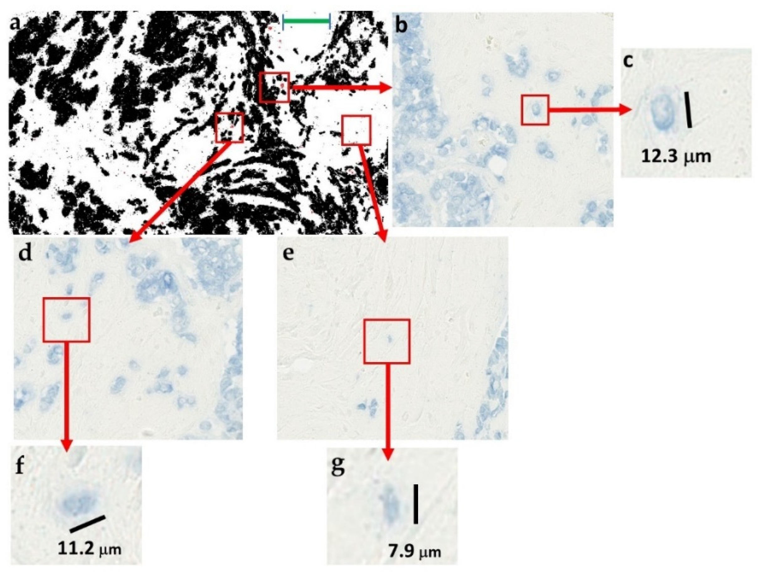 Cancers 11 01615 g004 Cancers 11 01615 g004