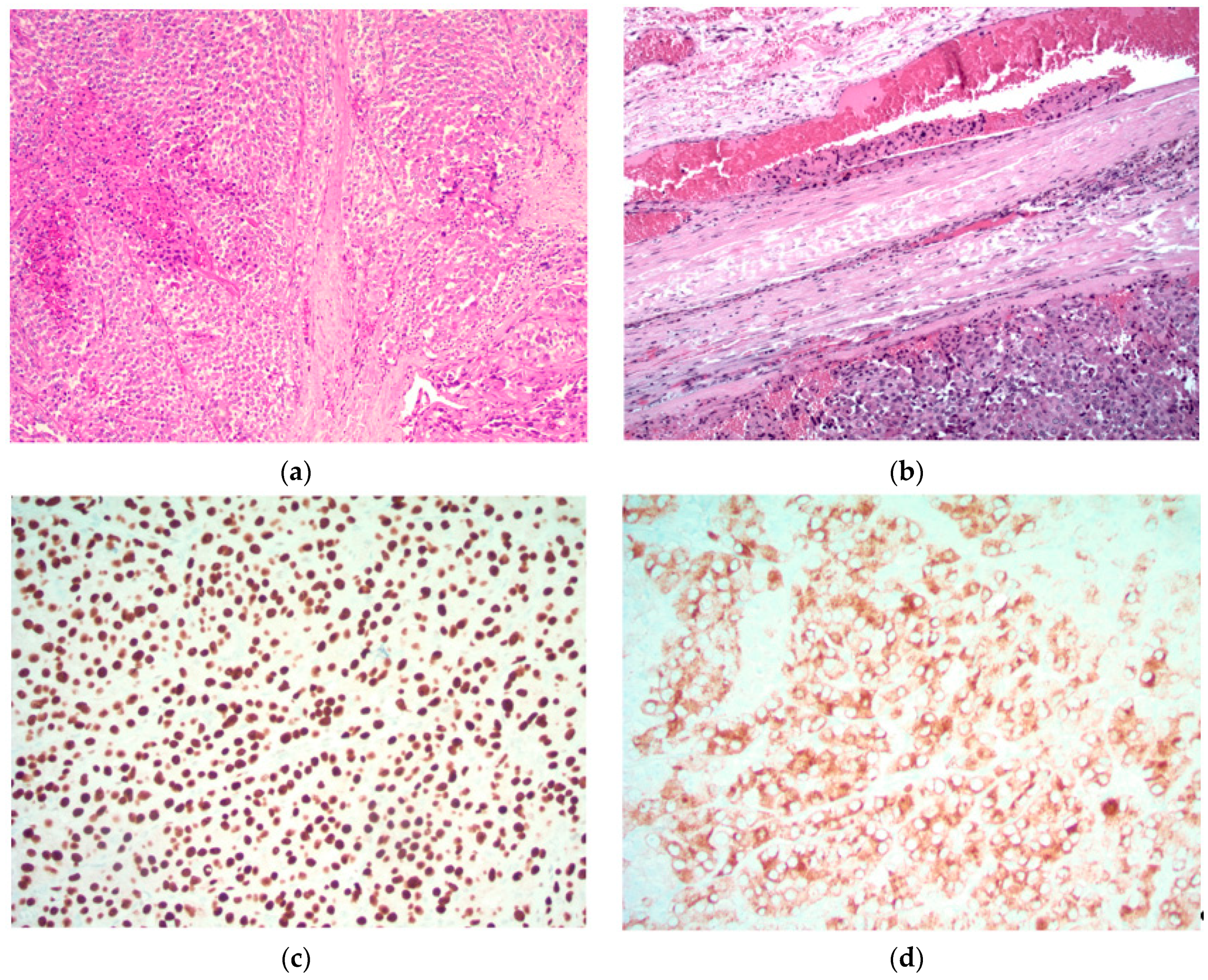 Cancers 11 01676 g001