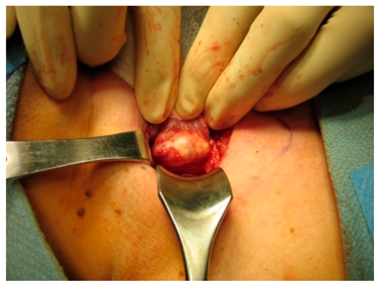 Cancers 11 01676 g002