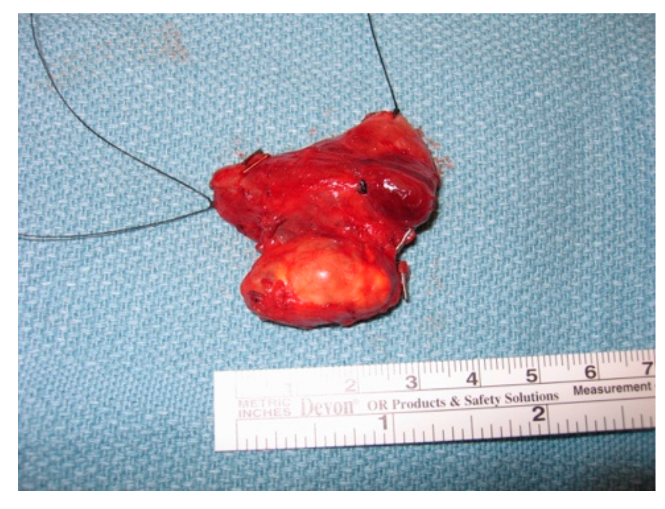 Cancers 11 01676 g003