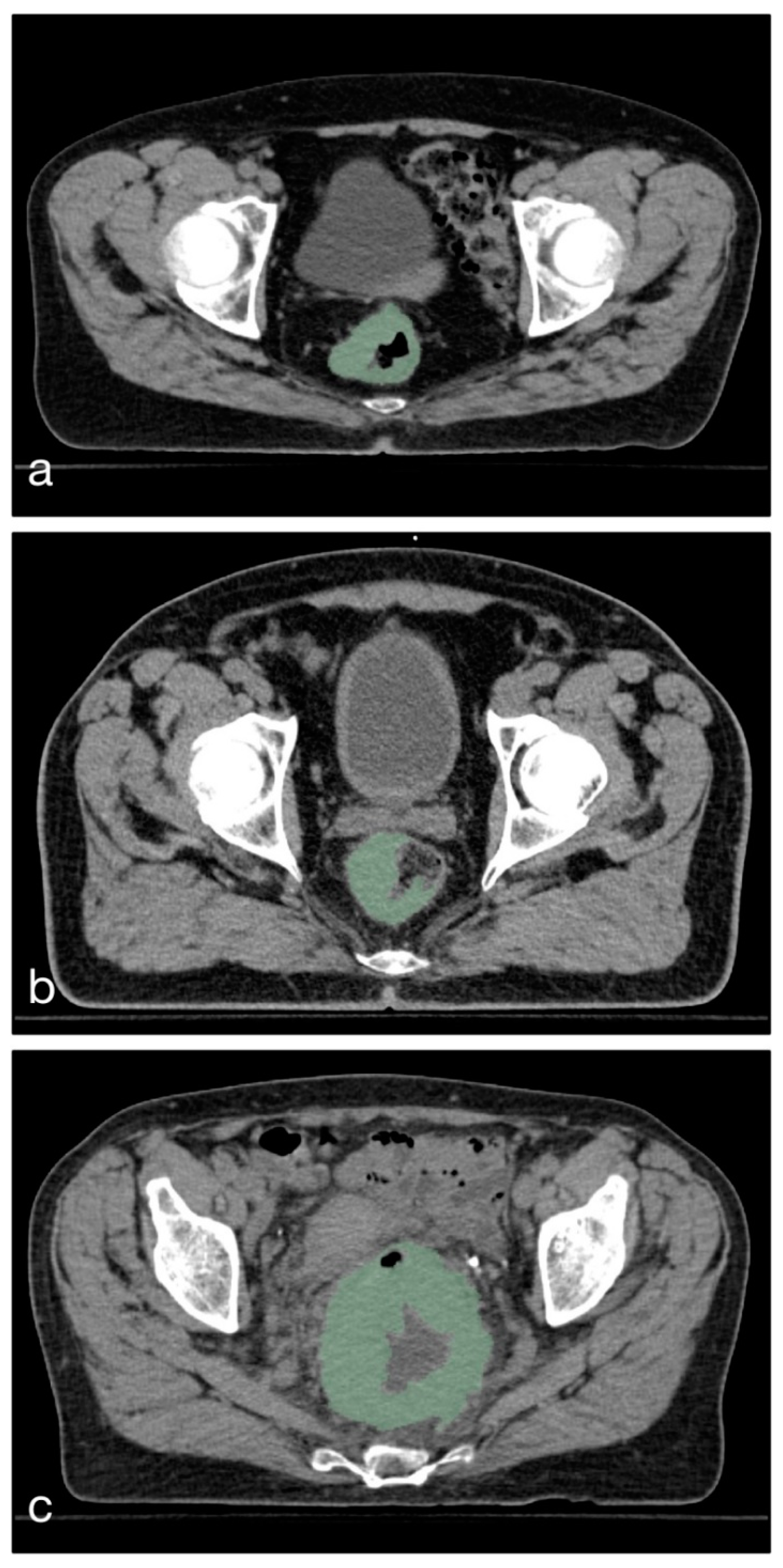 Cancers 11 01680 g002 Cancers 11 01680 g002