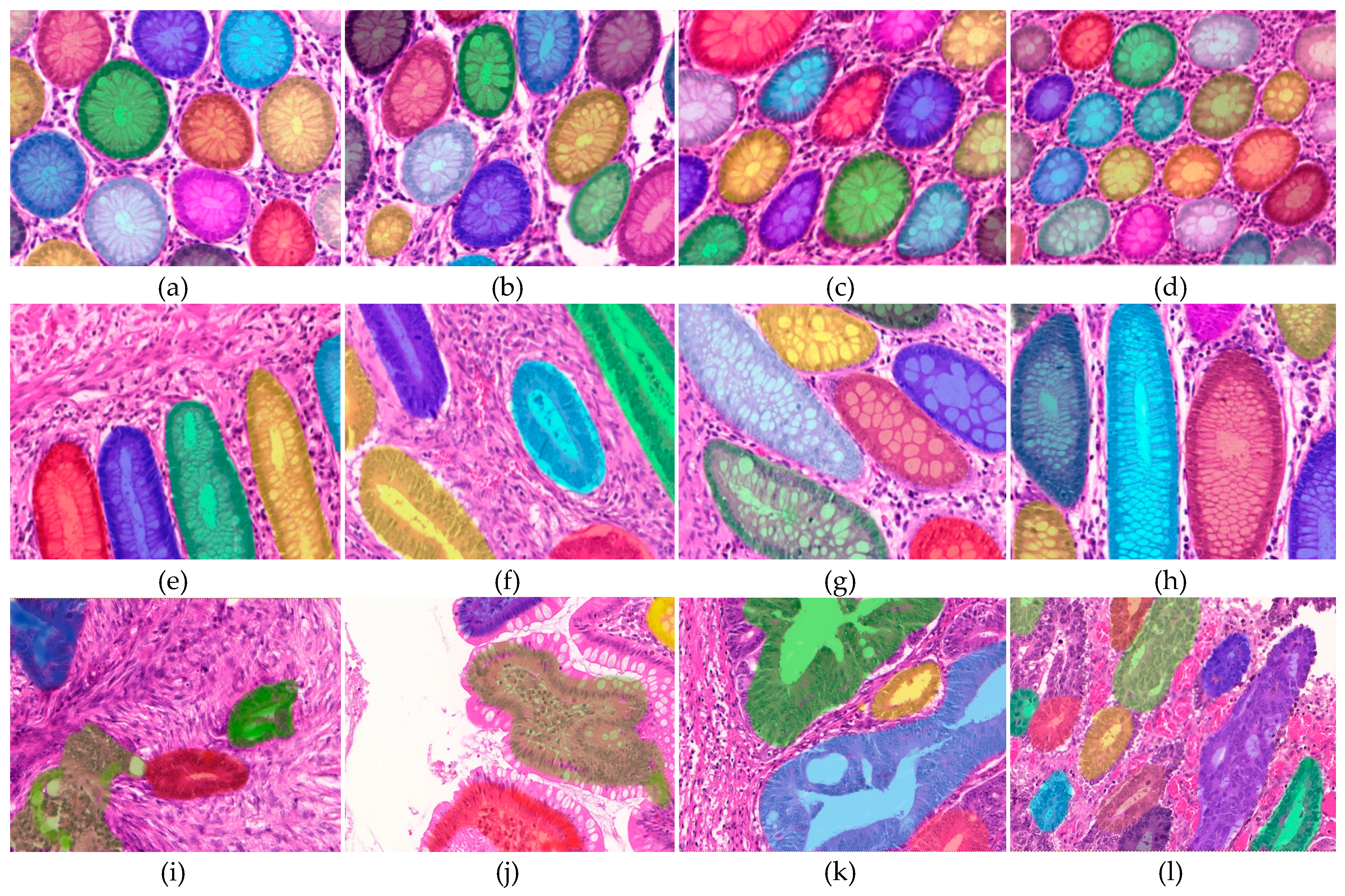 Cancers 11 01700 g003 Cancers 11 01700 g003