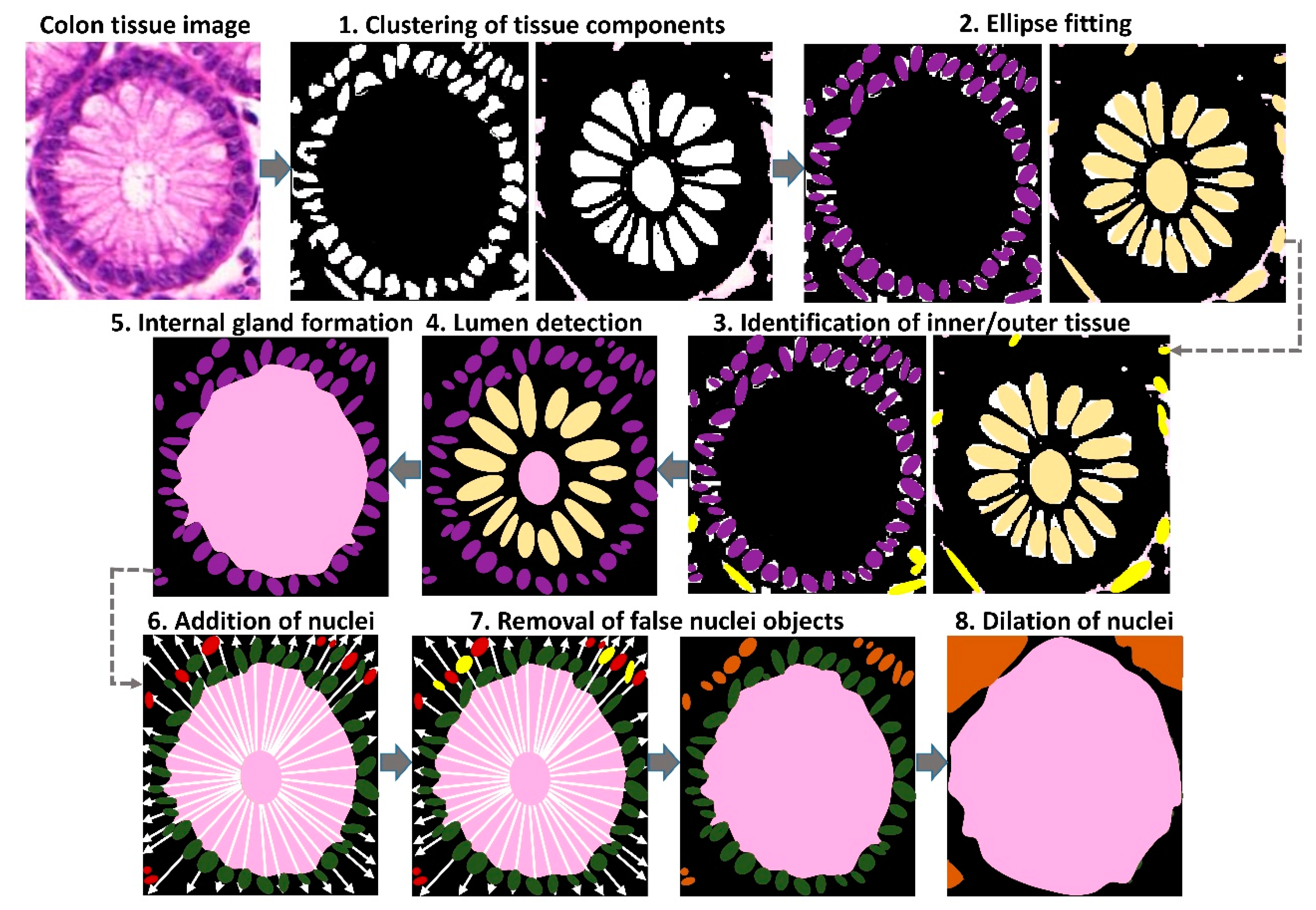 Cancers 11 01700 g006 Cancers 11 01700 g006