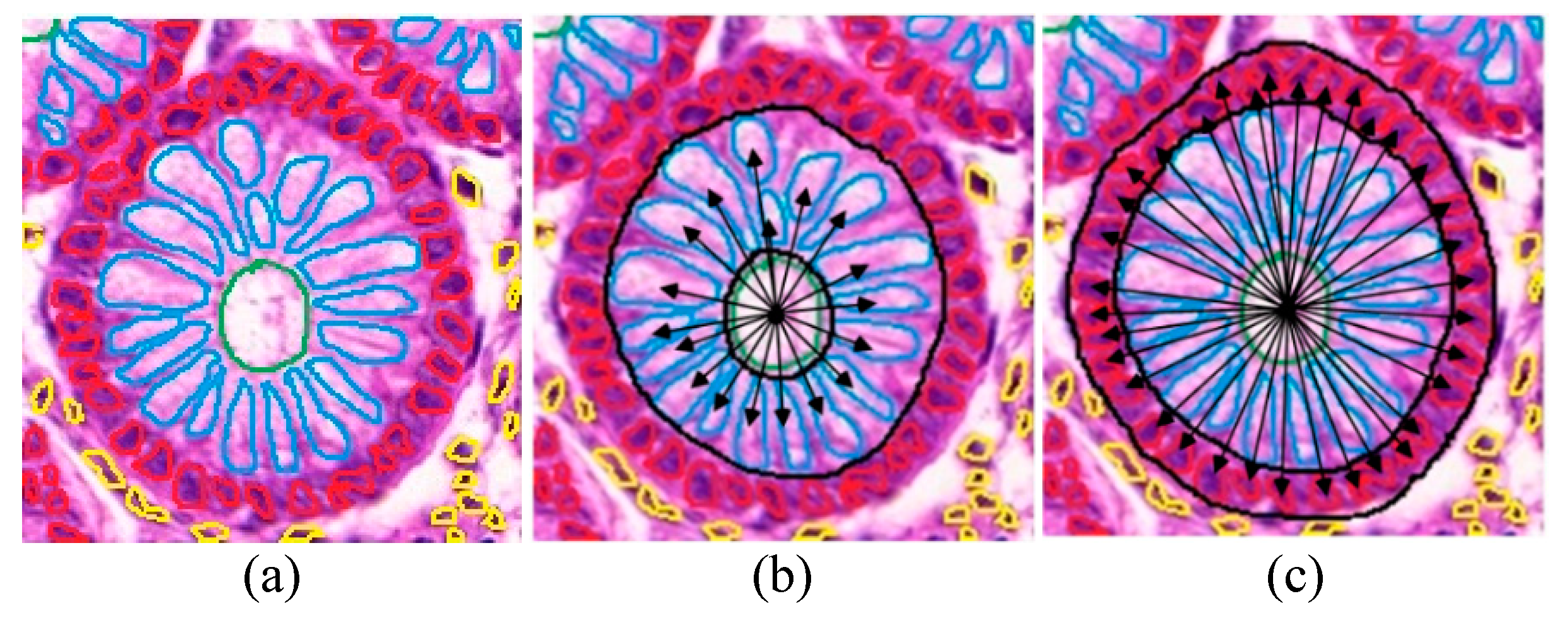 Cancers 11 01700 g007 Cancers 11 01700 g007