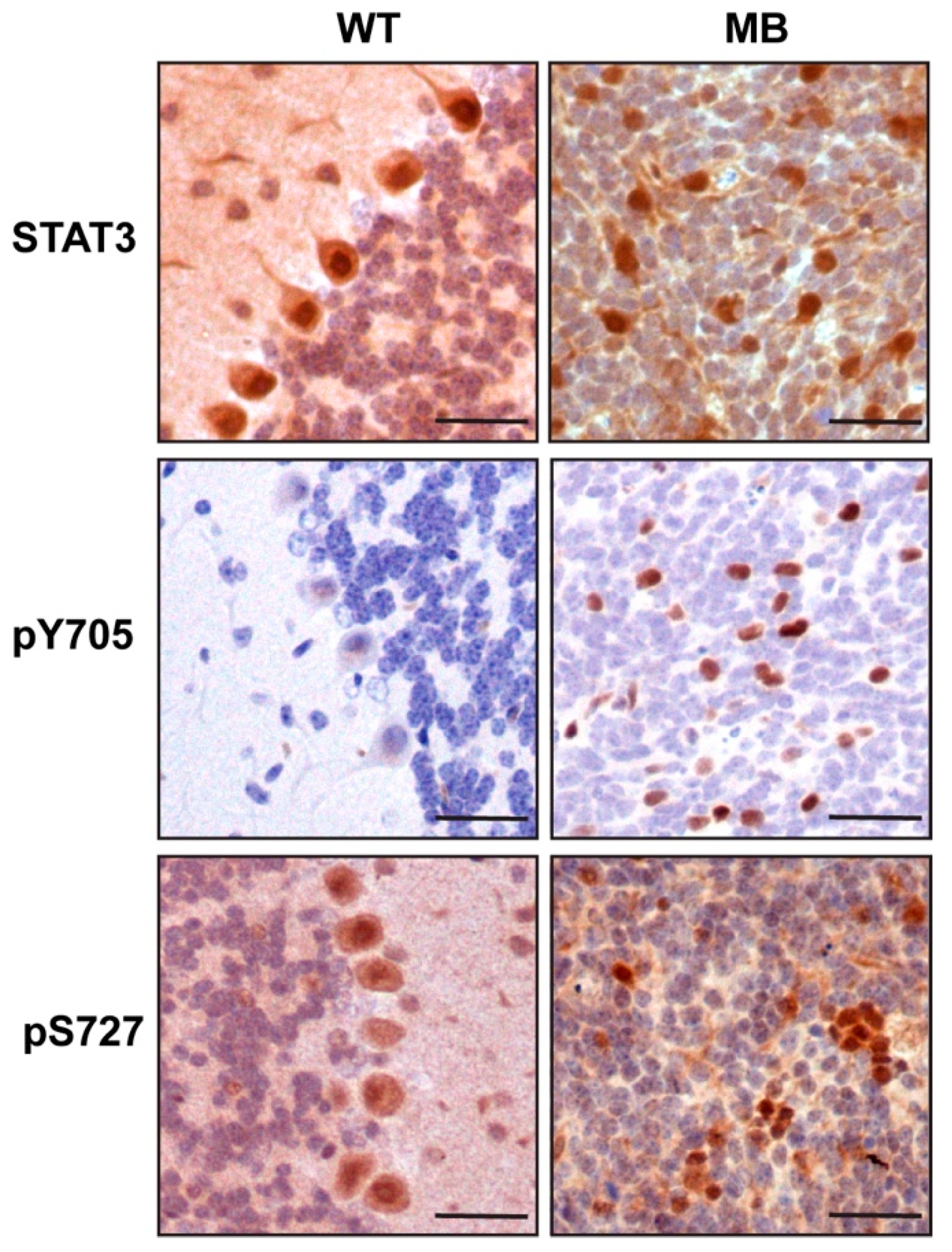 Cancers 11 01702 g001