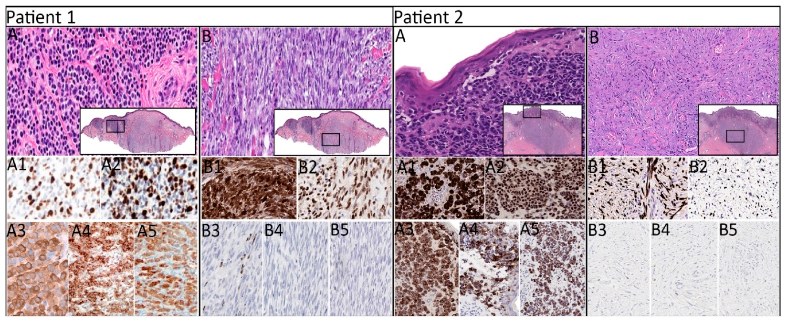 Cancers 11 01714 g001