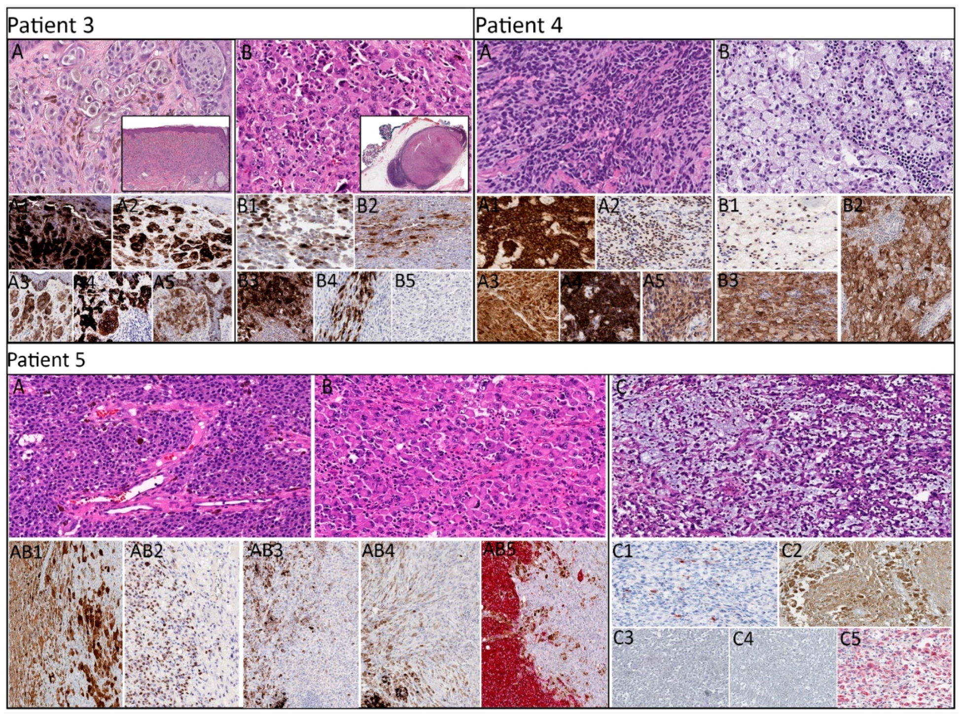 Cancers 11 01714 g002