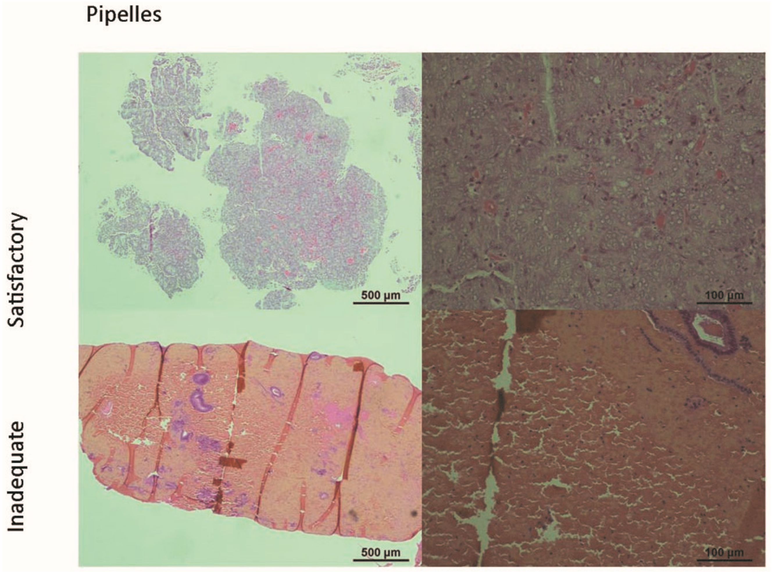 Cancers 11 01734 g001a