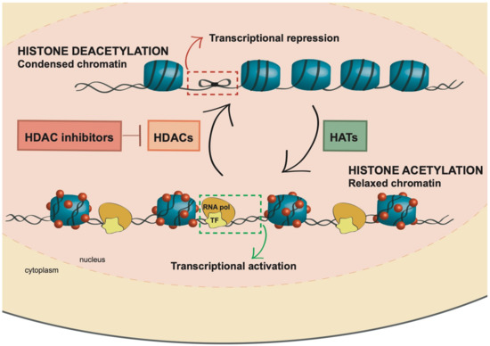 HDAC Inhibitors in Acute Myeloid Leukemia HDAC Inhibitors in Acute Myeloid Leukemia