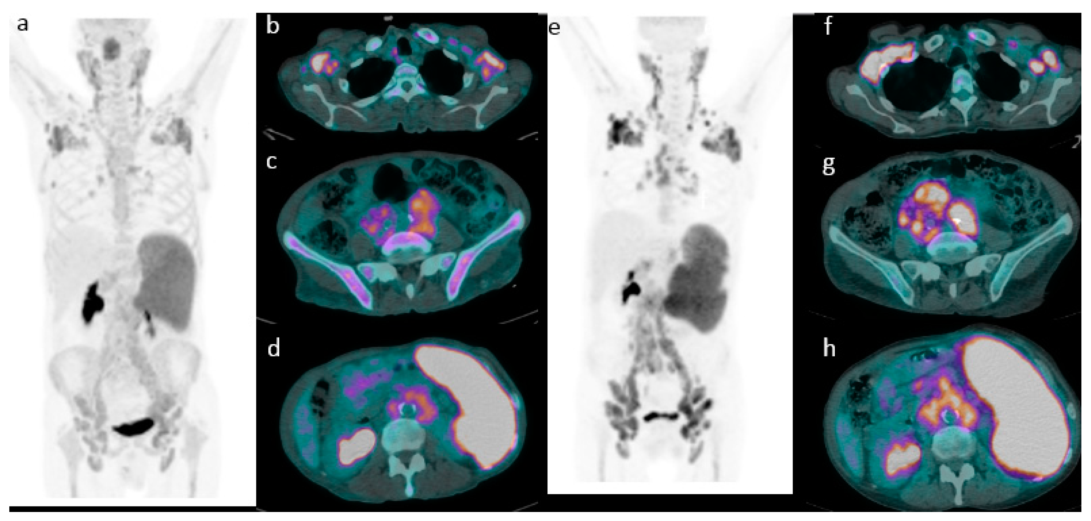 Cancers 11 01831 g002