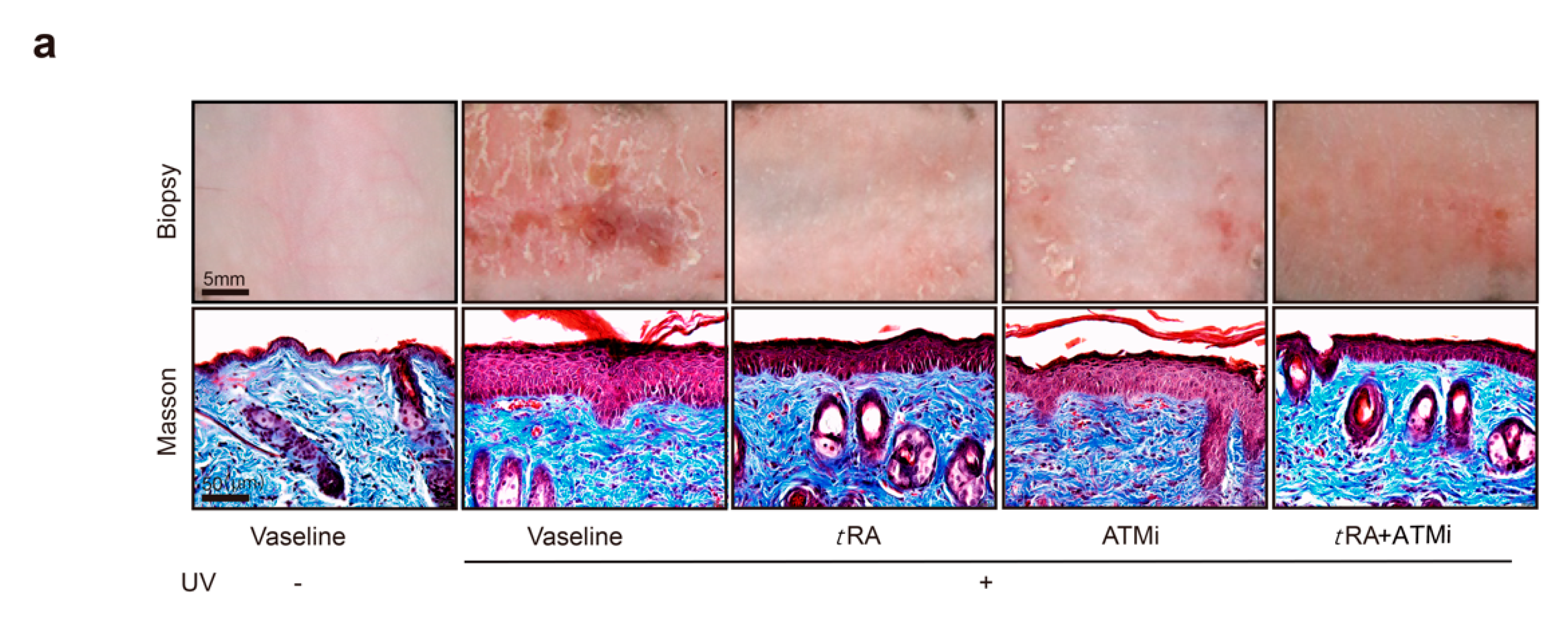 Cancers 11 01847 g005a Cancers 11 01847 g005a