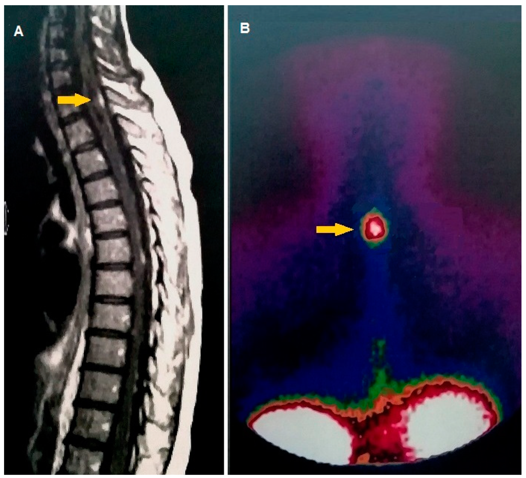 Cancers 11 01853 g002 Cancers 11 01853 g002