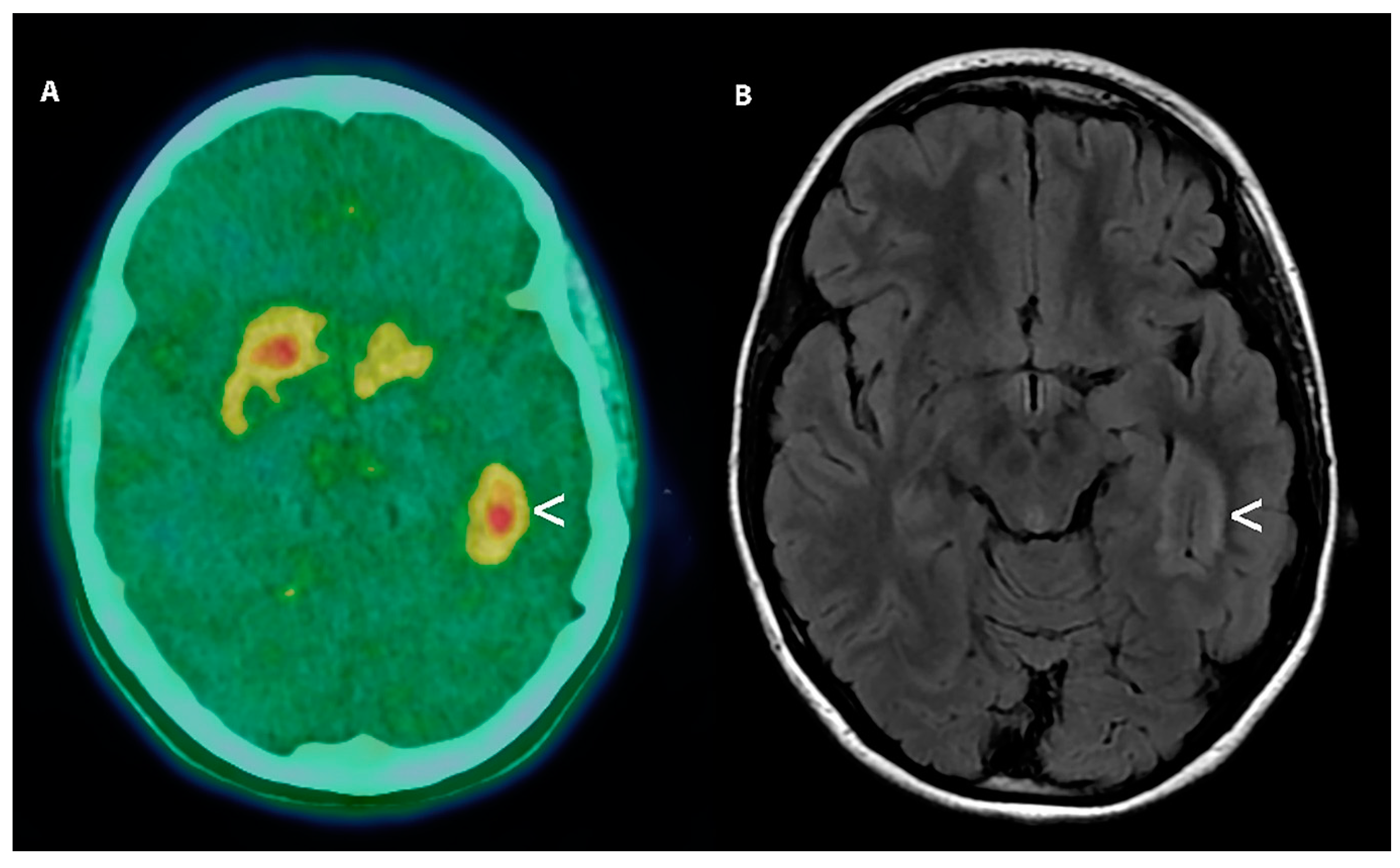 Cancers 11 01853 g006 Cancers 11 01853 g006