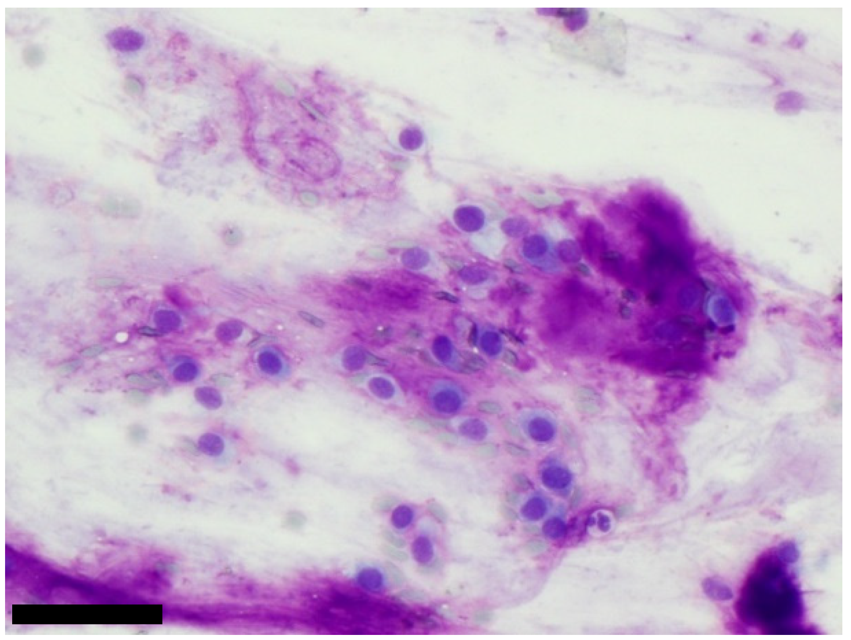 Cancers 11 01912 g001 550