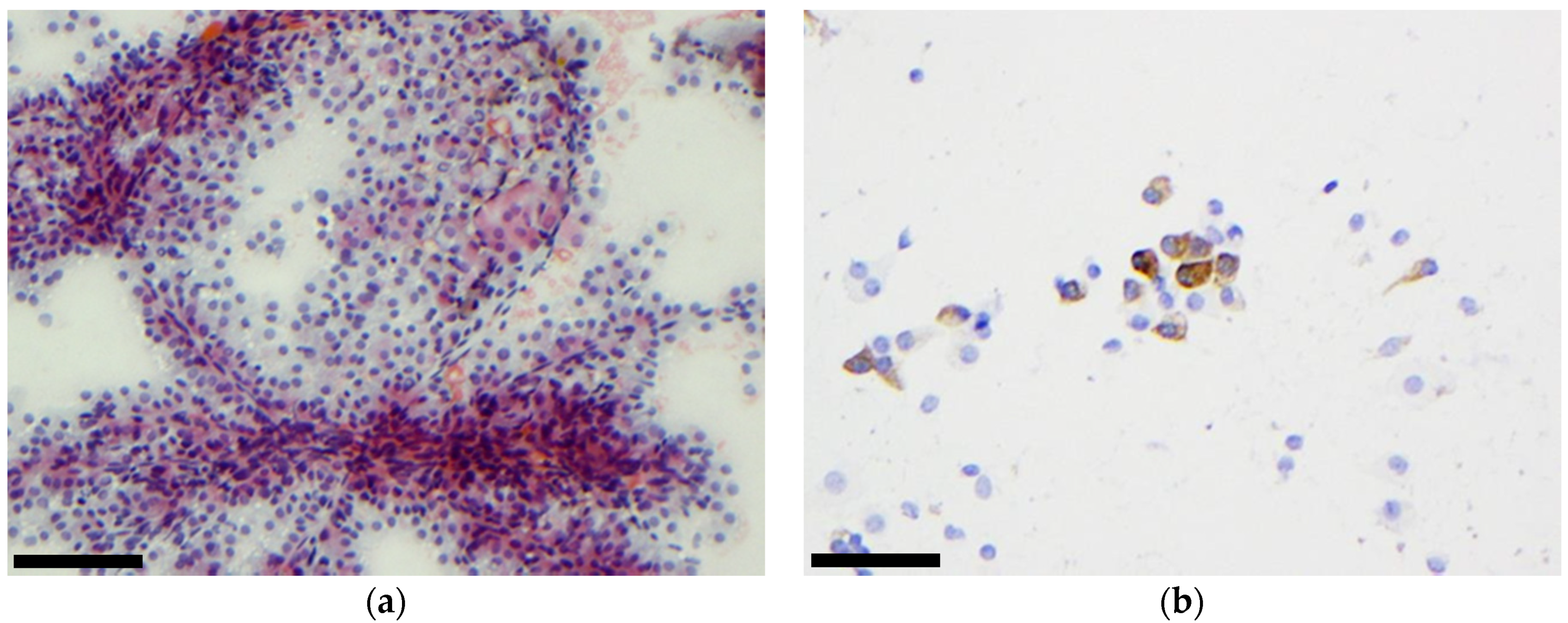 Cancers 11 01912 g003 550