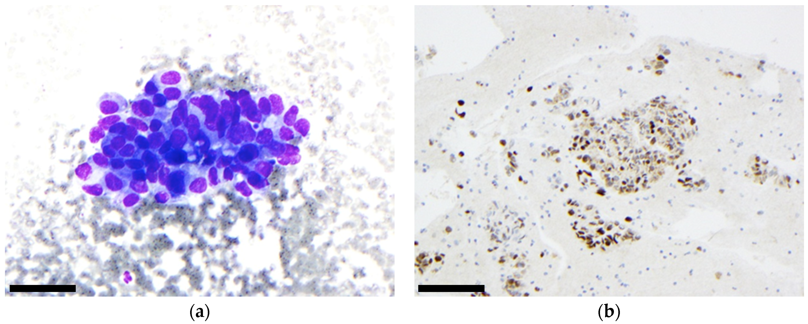 Cancers 11 01912 g004 550