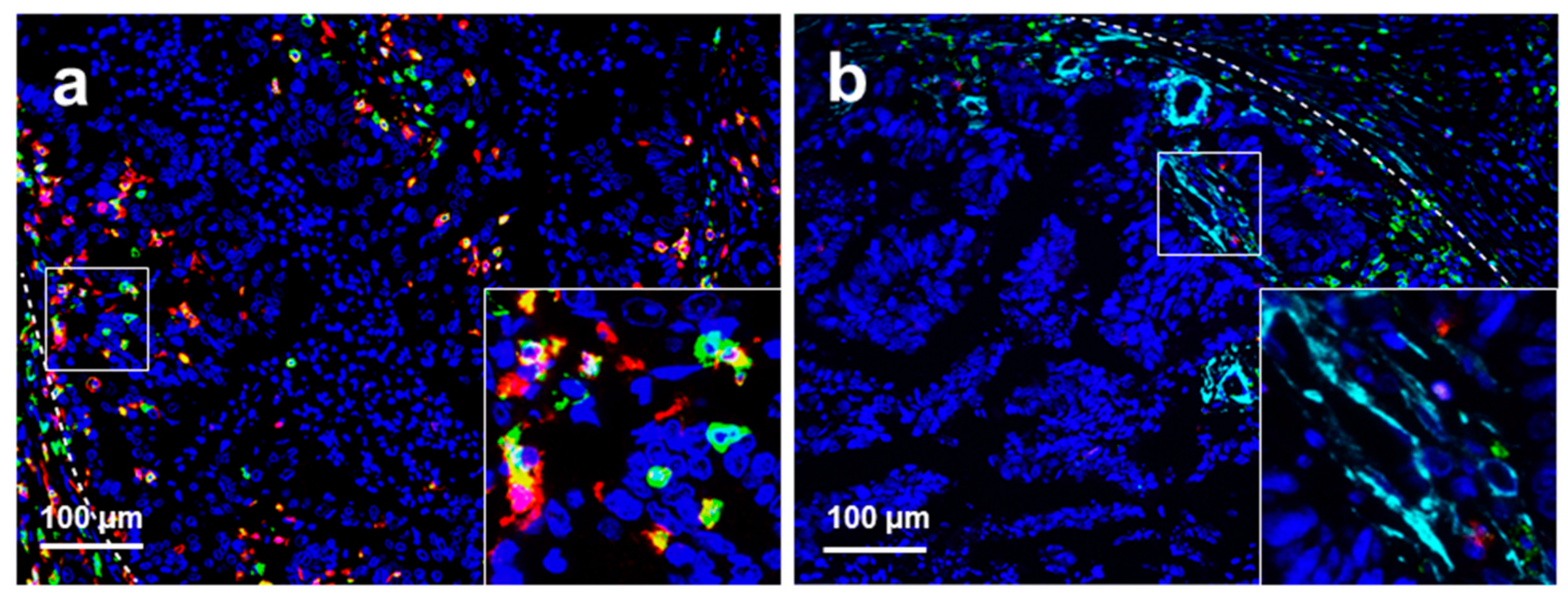 Cancers 11 01922 g004a Cancers 11 01922 g004a