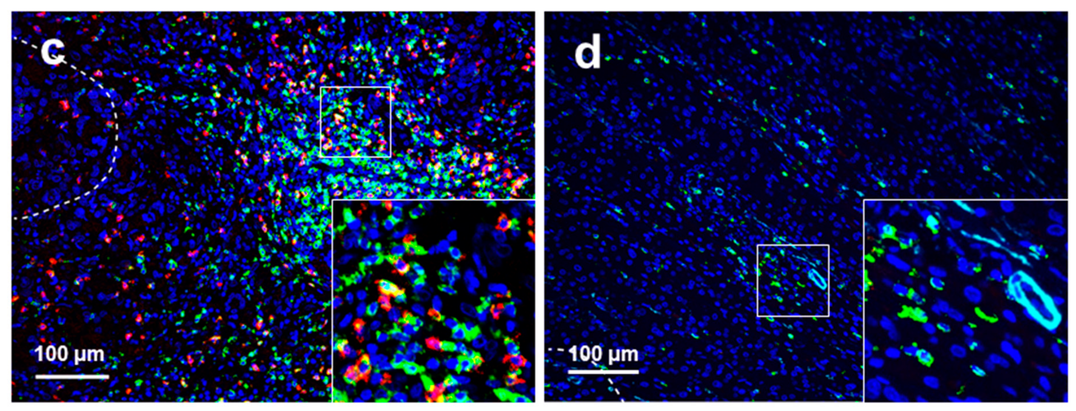 Cancers 11 01922 g004b Cancers 11 01922 g004b