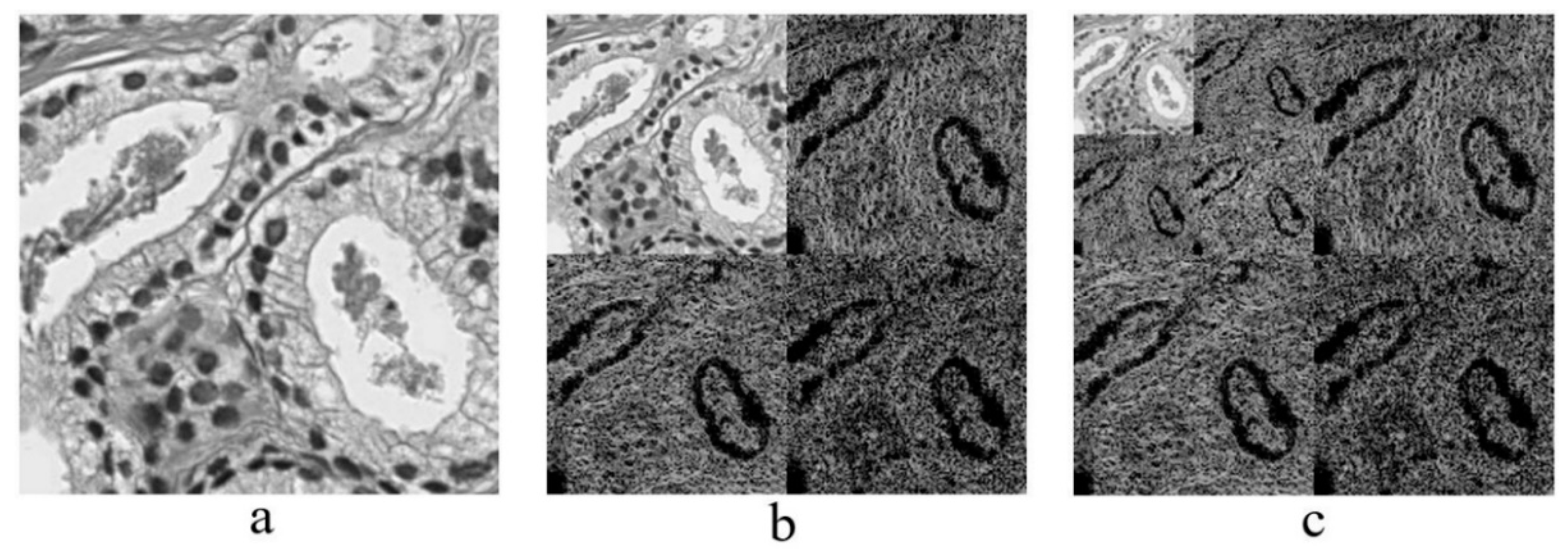 Cancers 11 01937 g005