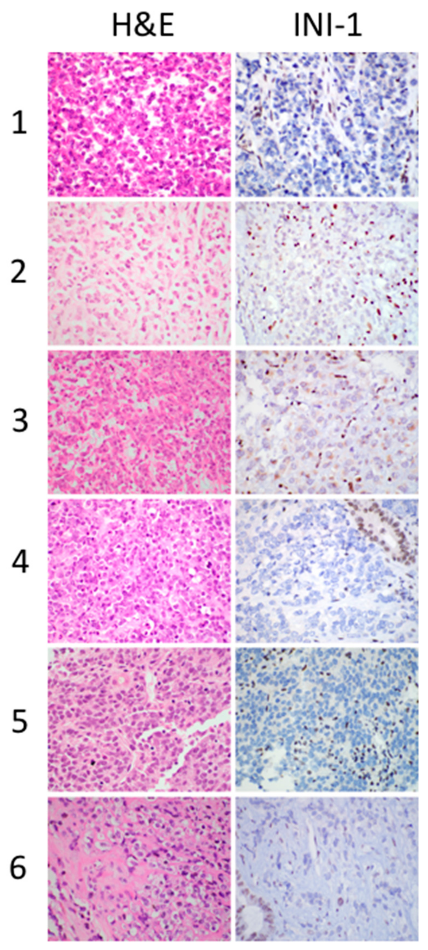 Cancers 11 01992 g002