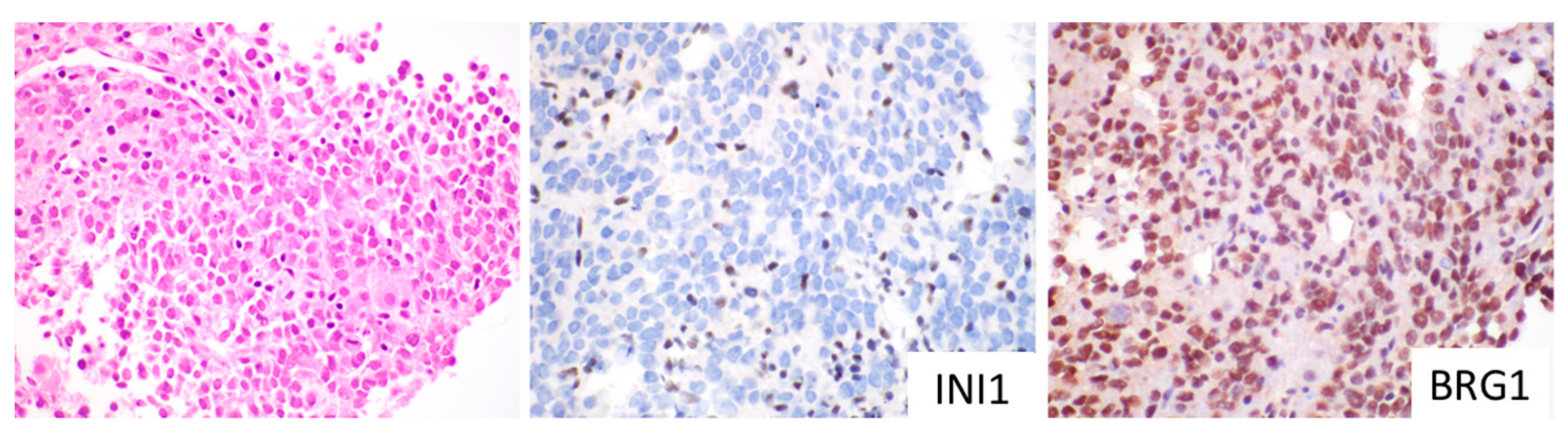 Cancers 11 01992 g004