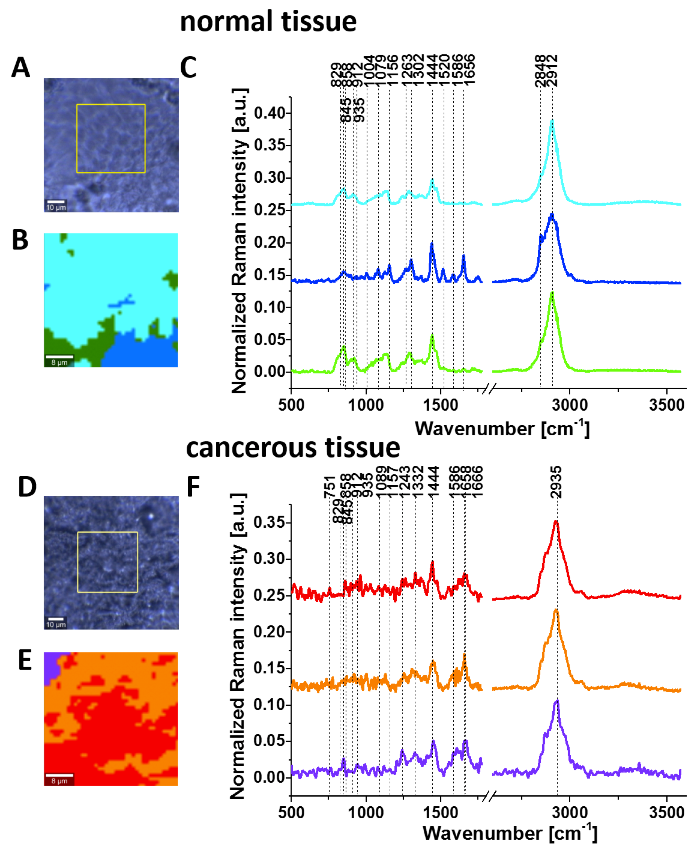 Cancers 11 02017 g003