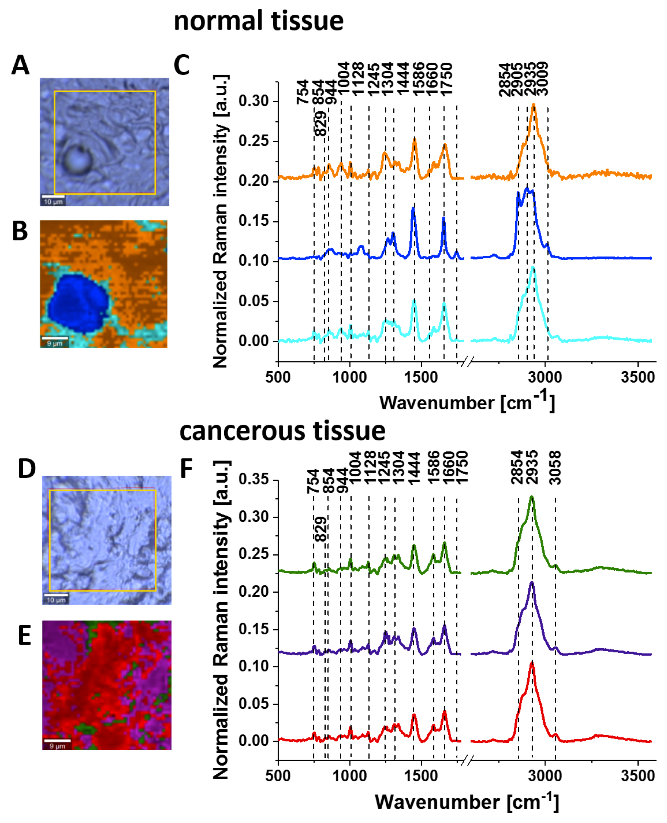 Cancers 11 02017 g005