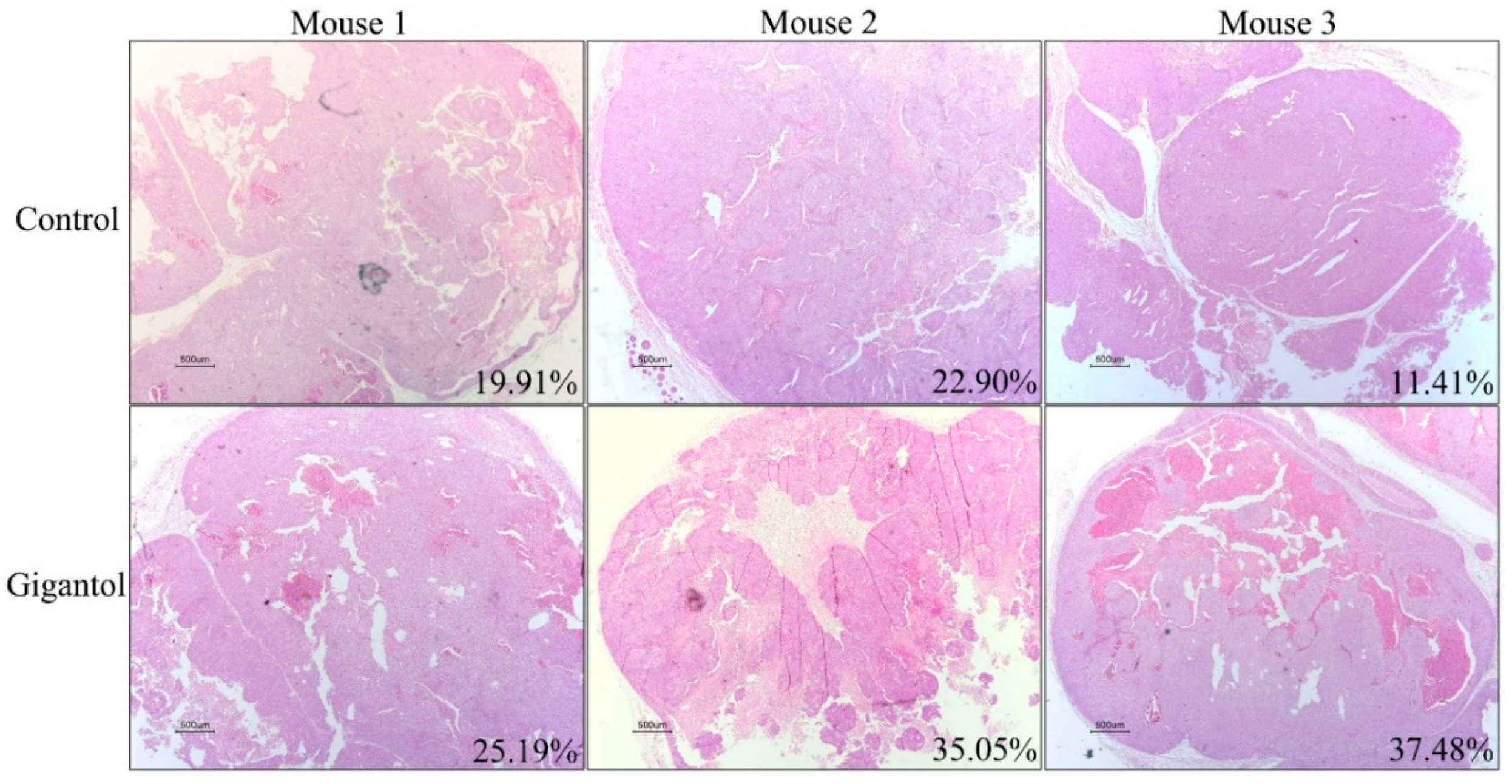 Cancers 11 02032 g006 Cancers 11 02032 g006